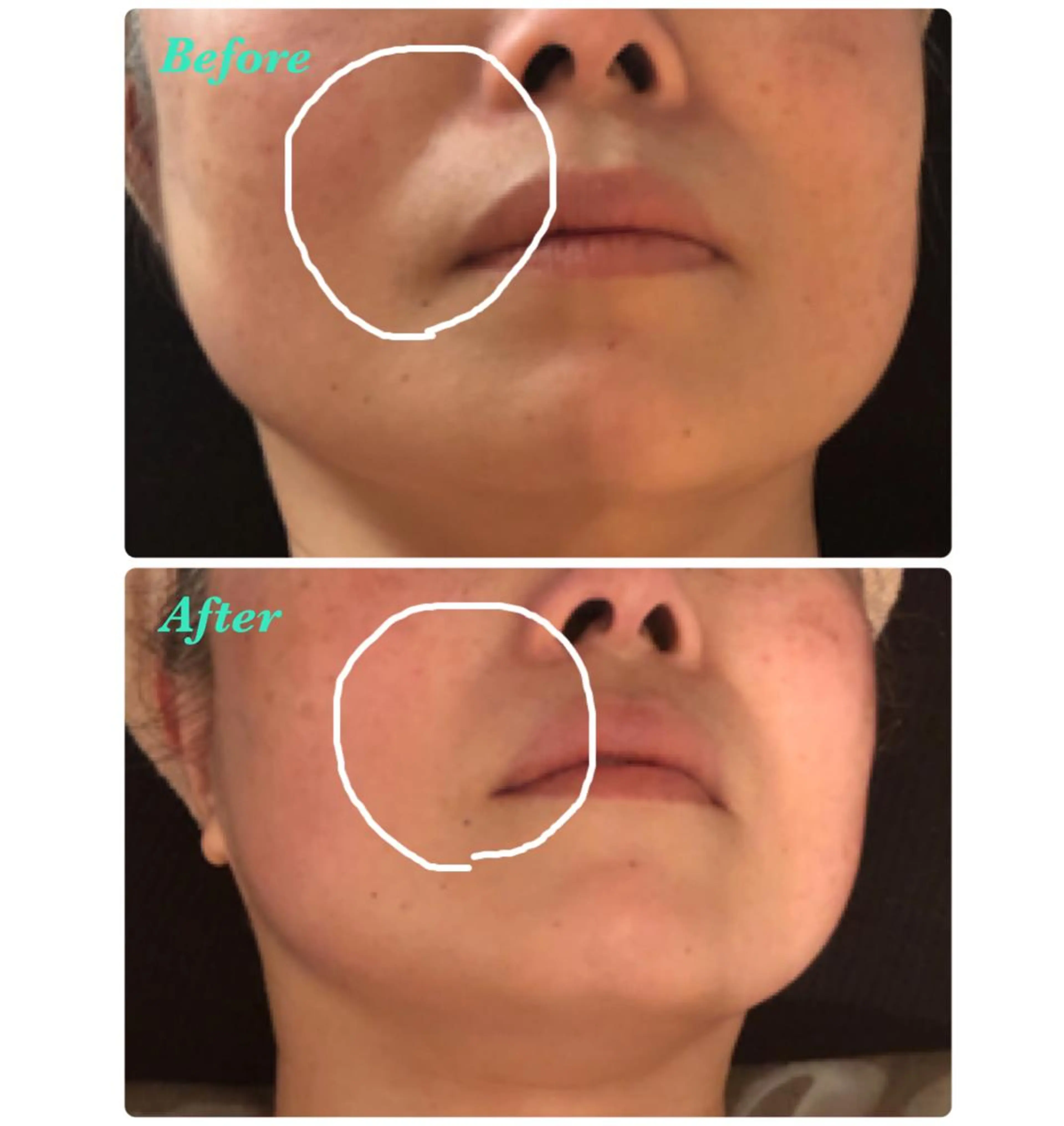 横浜石川町 こりケア 専門lala mouのエステ・リラクイメージ