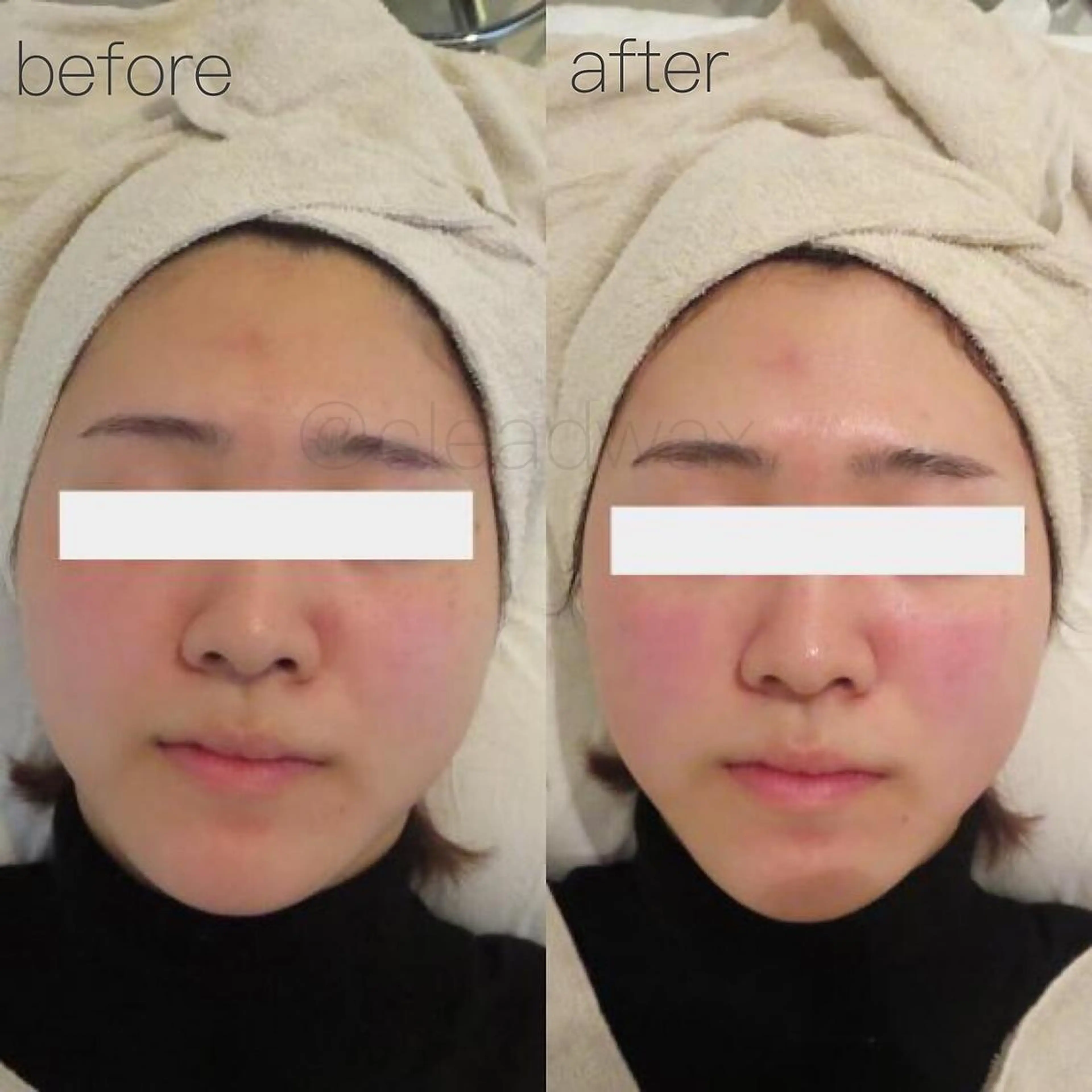 エステ CLEAD 赤坂のエステ・リラクイメージ