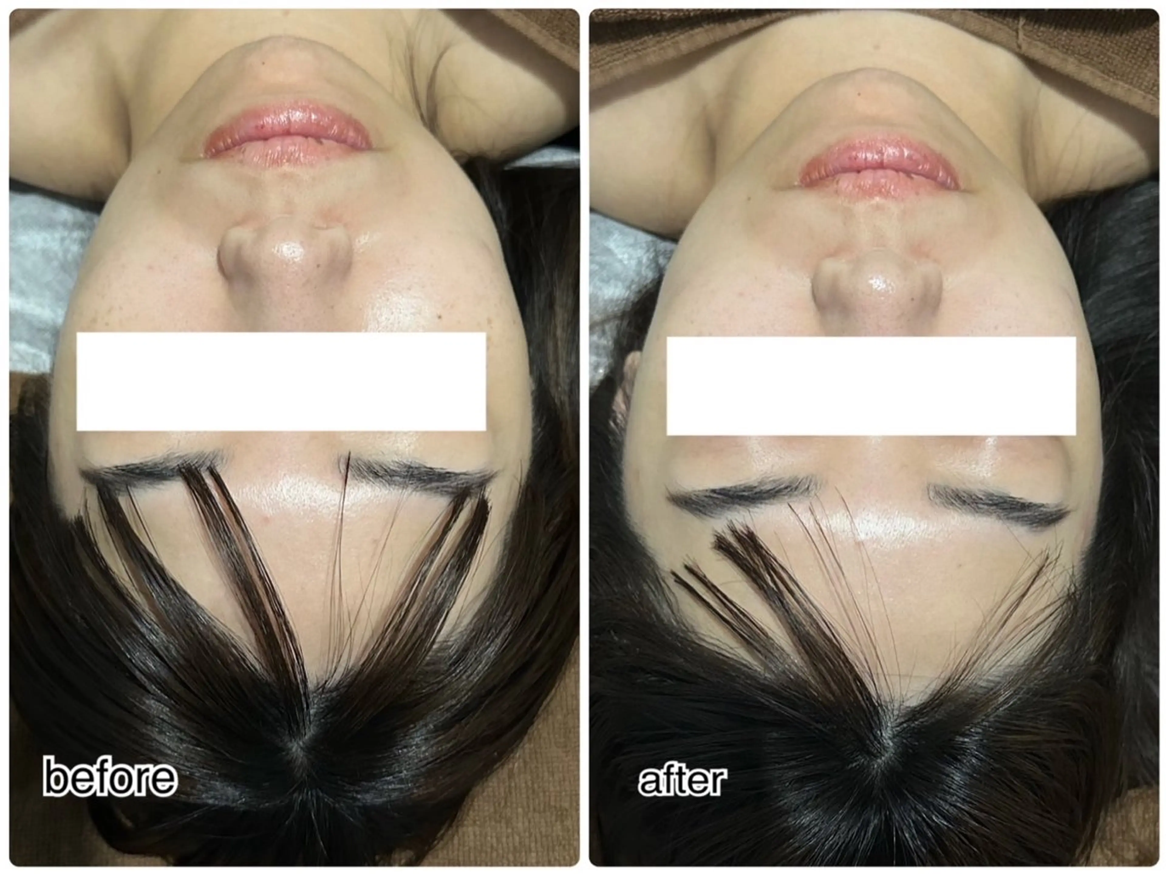 エステ ENCHANT Kaede/肌質改善のその他イメージ