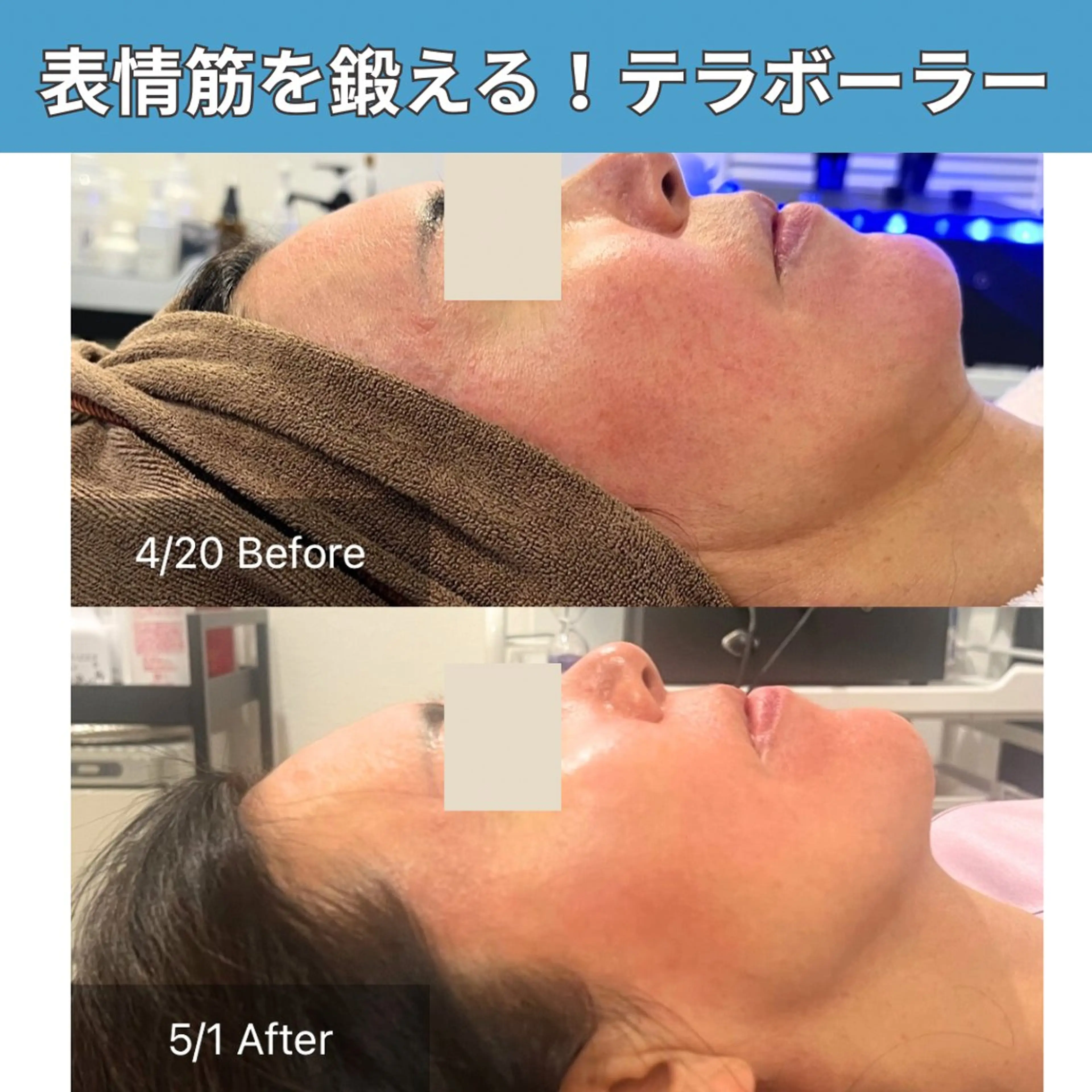 その他 ielu〜毛穴ケア ハーブピーリングのエステ・リラクイメージ