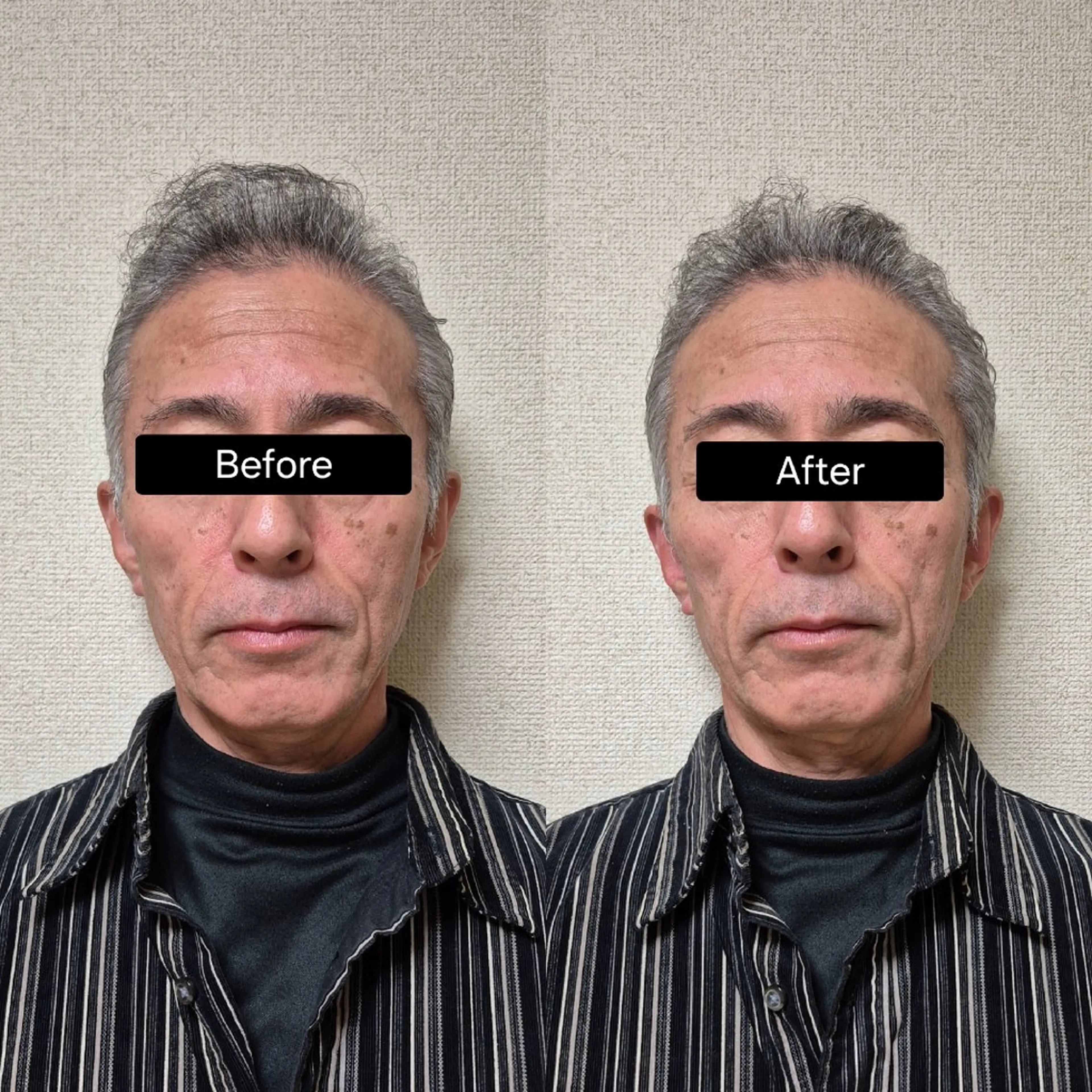 頭と顔の専門店LN│ ヘッドスパ×小顔矯正のエステ・リラクイメージ