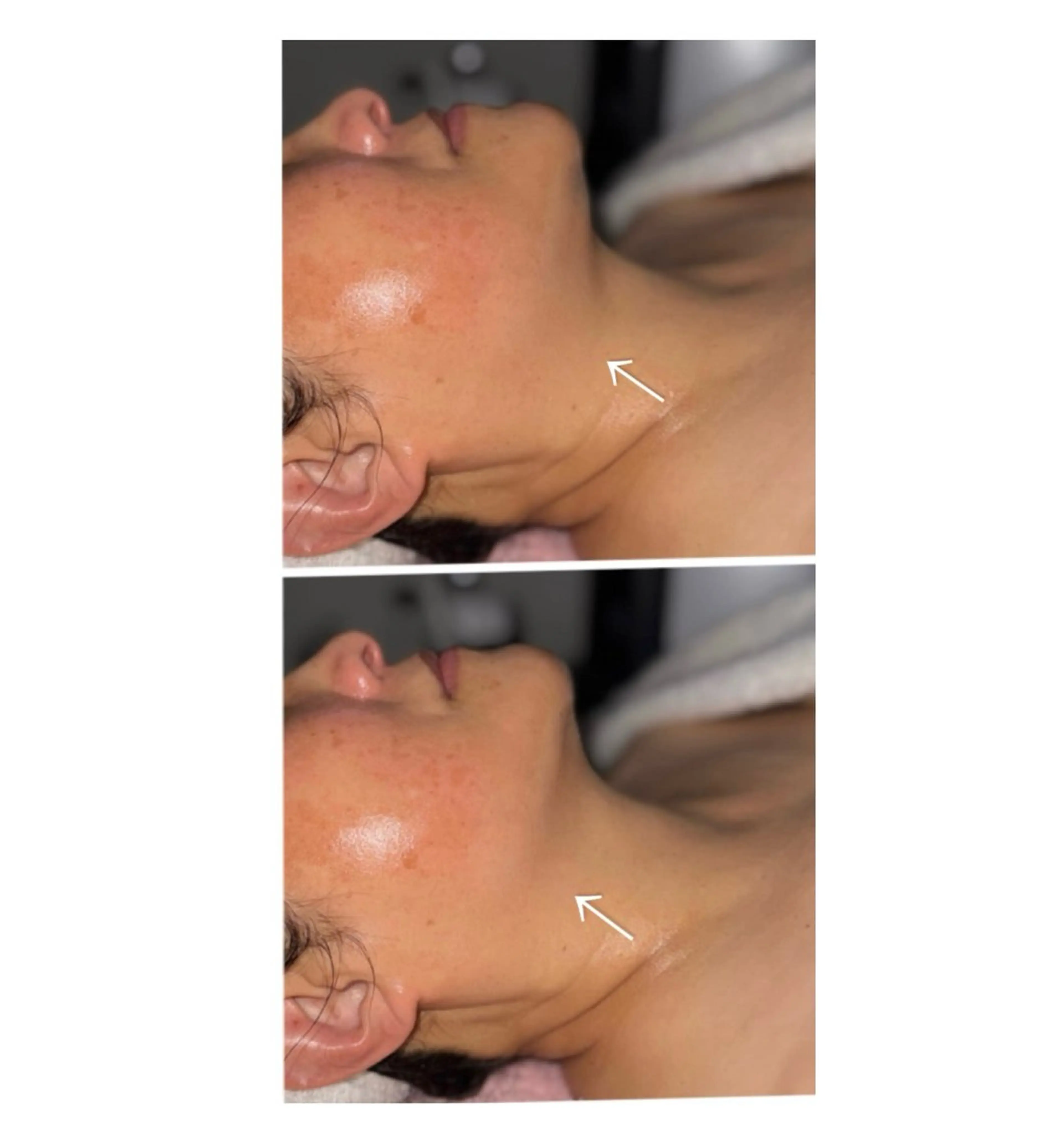 本格派エステ ハピスリーのエステ・リラクイメージ