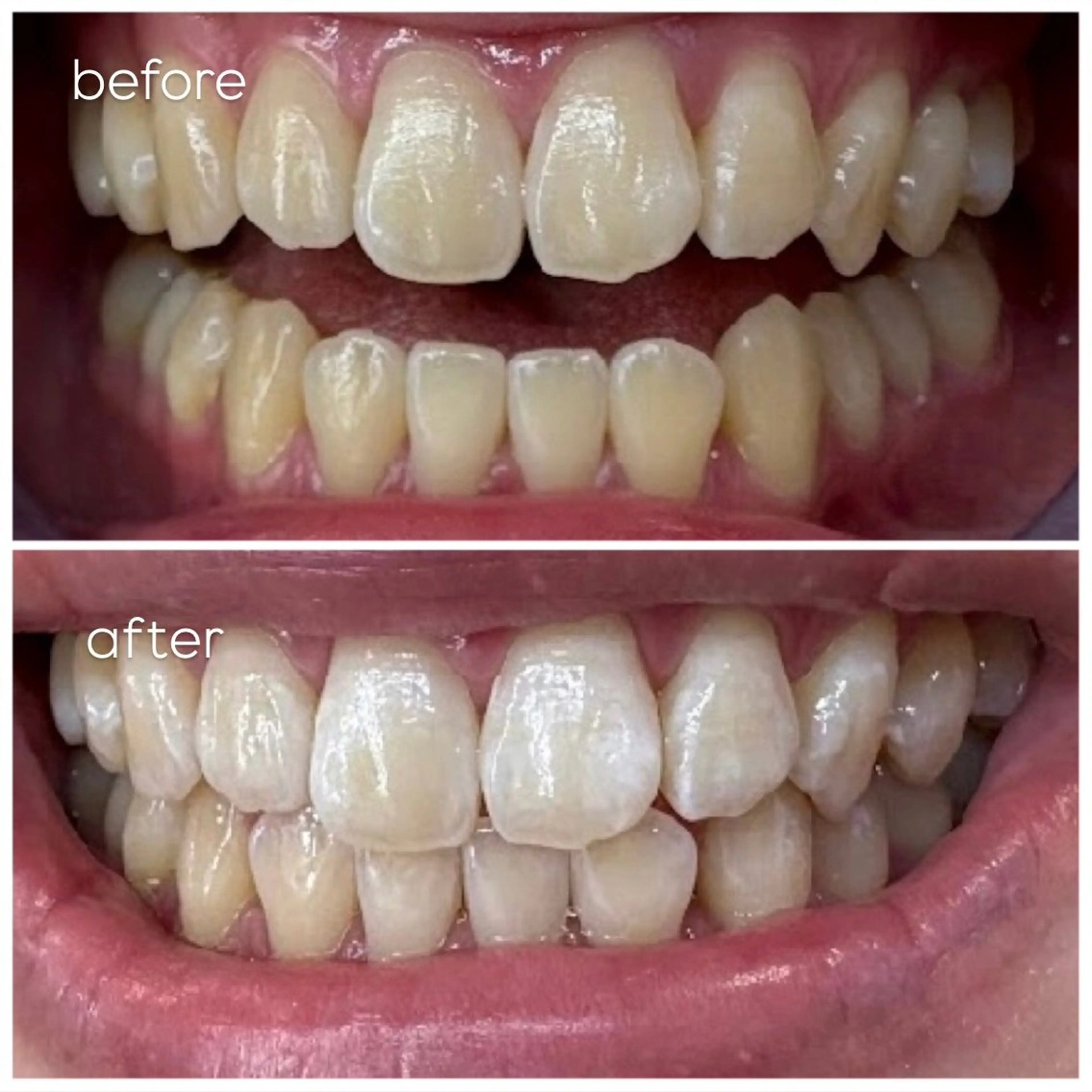 エクシア津駅前店所属・セルフホワイトニング エクシア津駅前店のその他イメージ