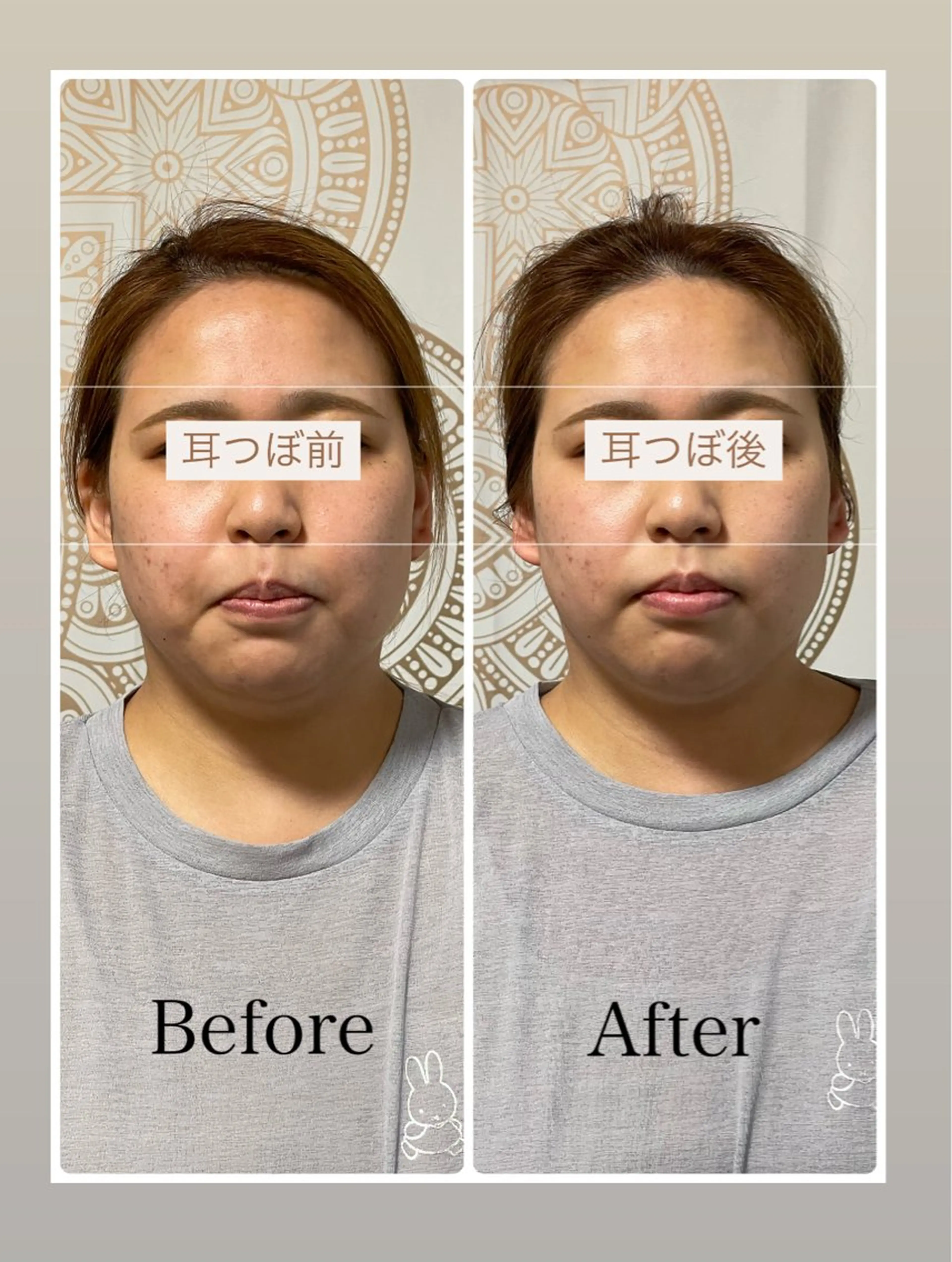 あだち整体エステ 首肩背中のゆるめぐのエステ・リラクイメージ