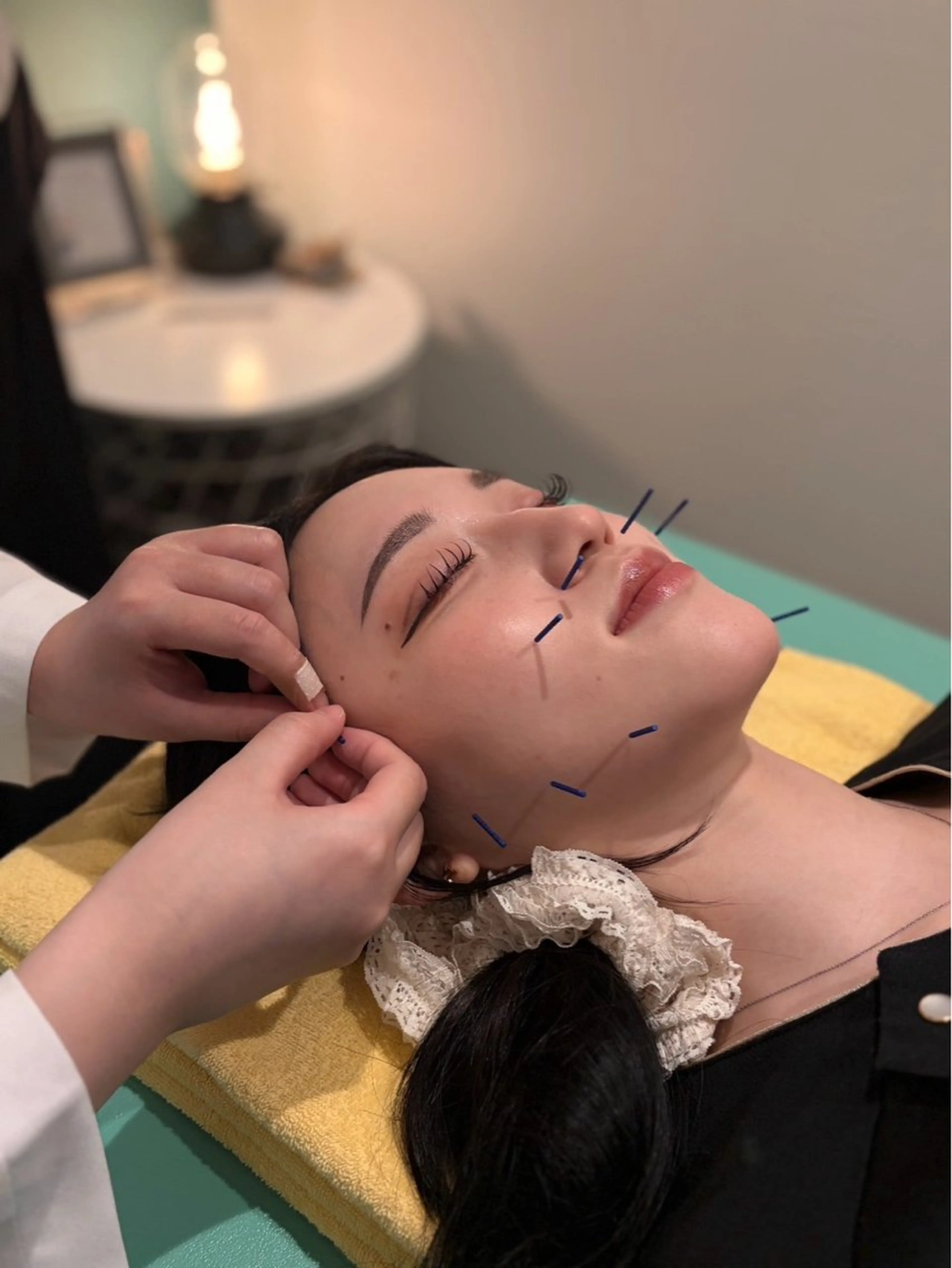 エステ nano.face名古屋駅前店所属・美容鍼/小顔&整体 nano.faceのエステ・リラクイメージ