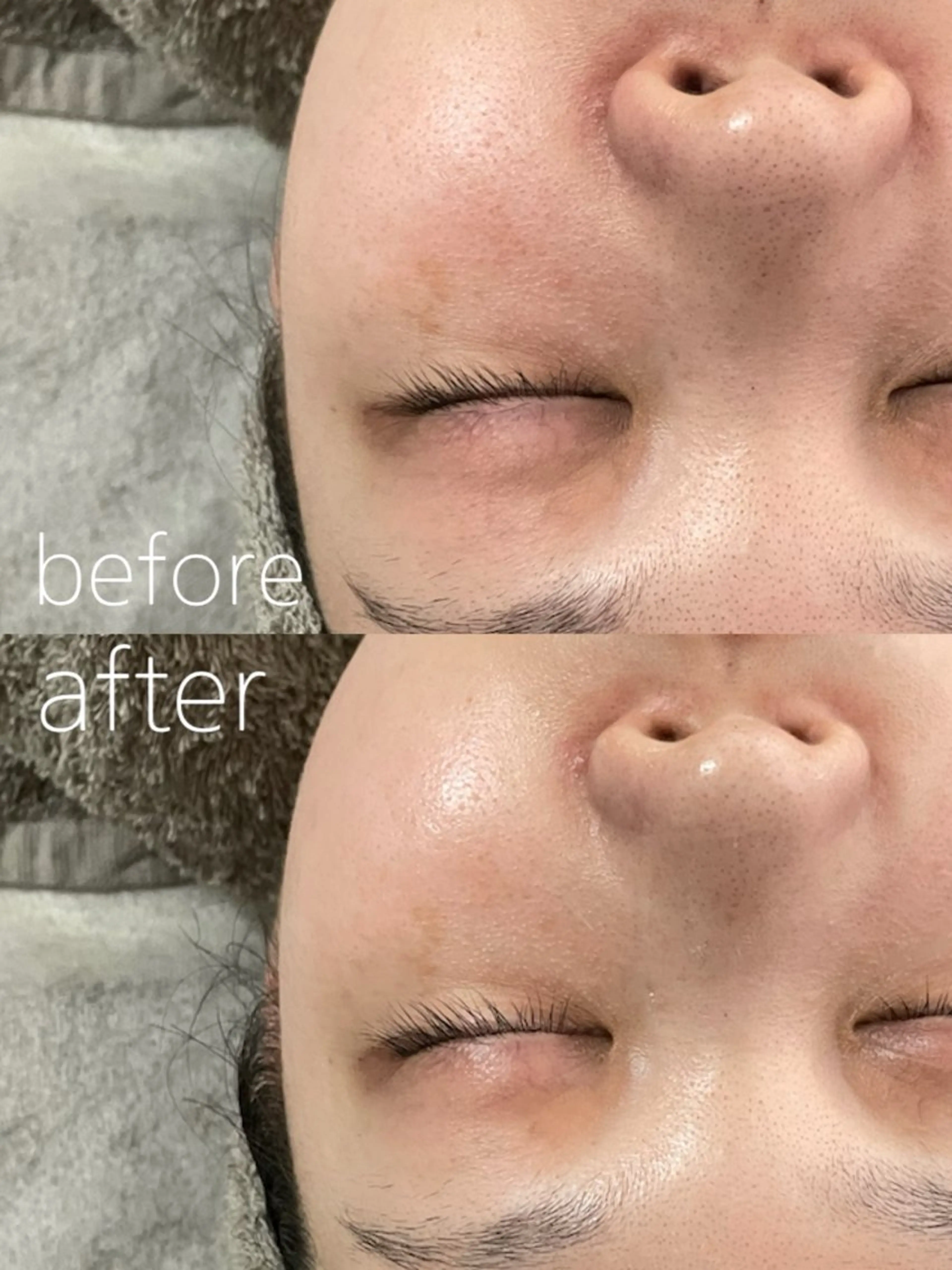 LBSホワイトニング 🌐岡山店のその他イメージ