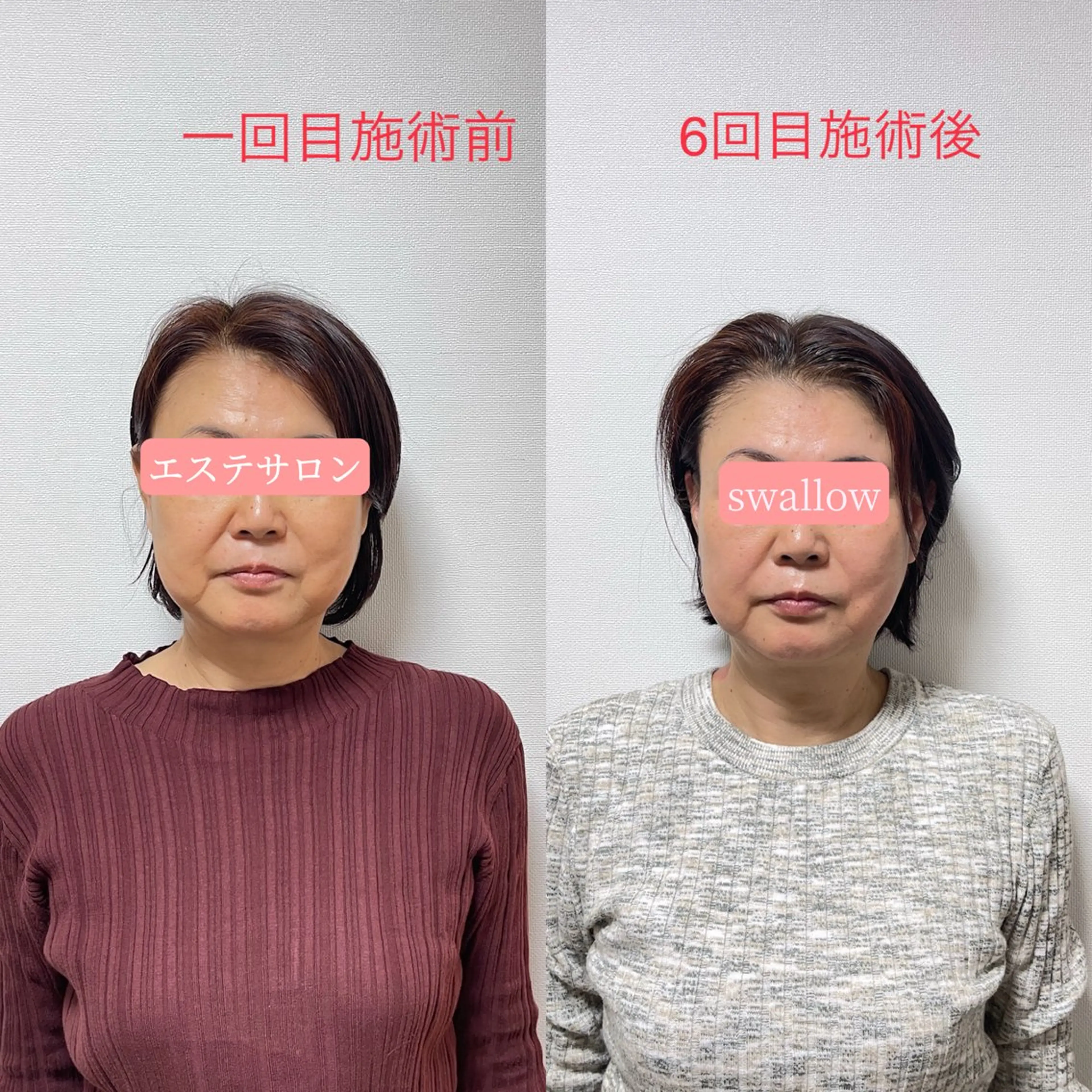 エステ リラク エステサロン swallowのエステ・リラクイメージ