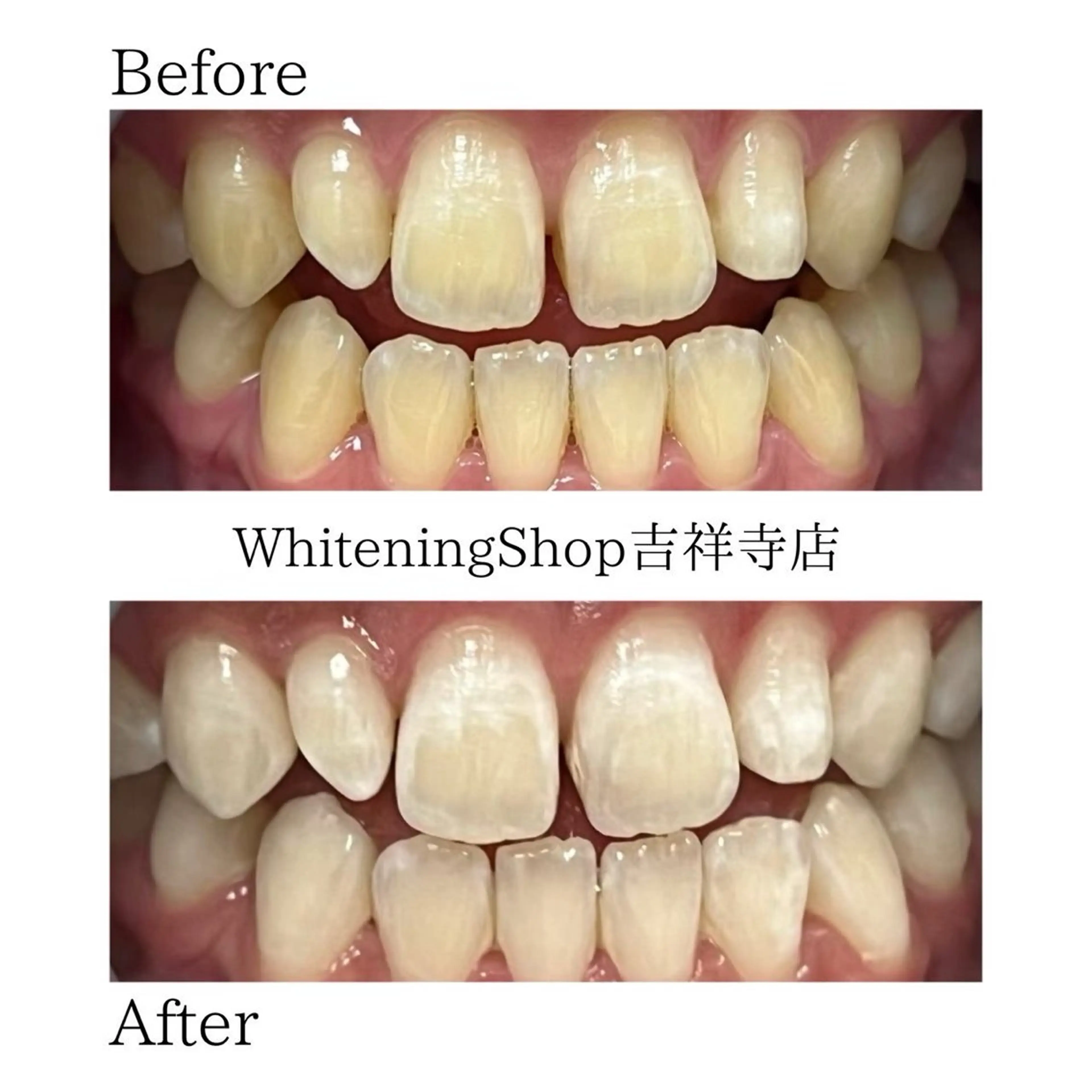 ホワイトニングショッ 吉祥寺2号店のその他イメージ