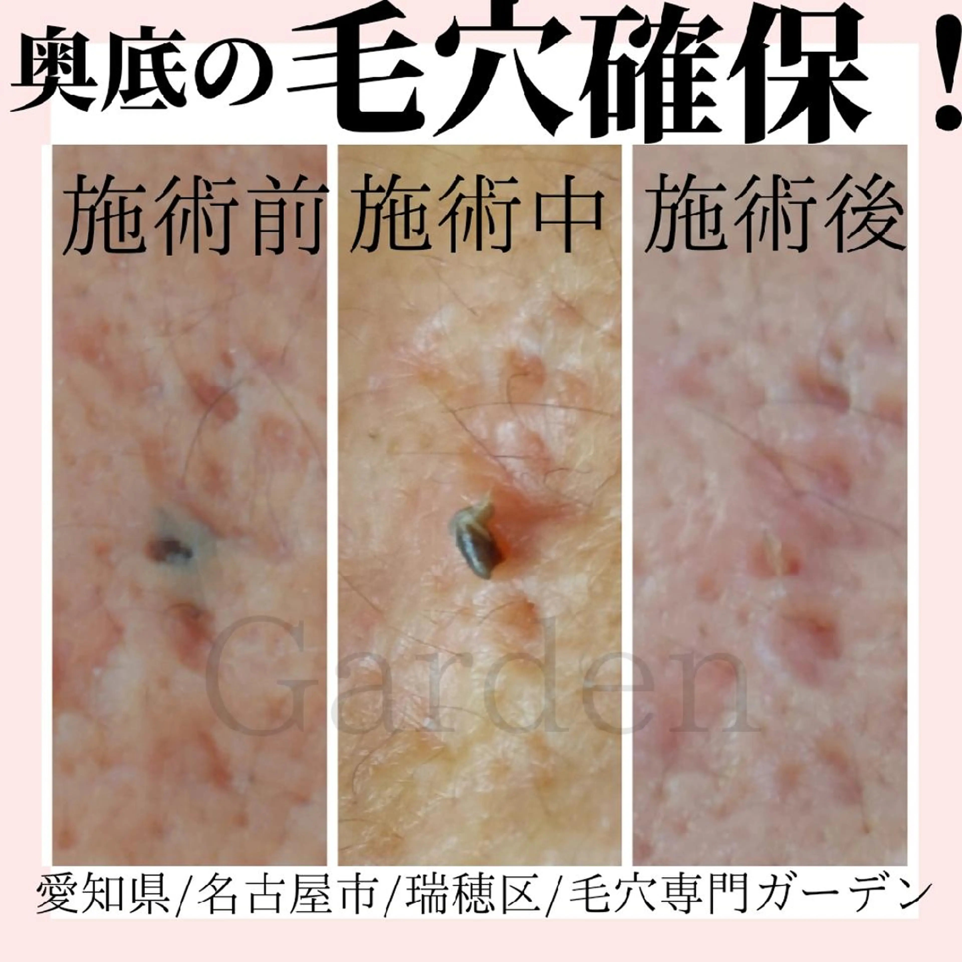 プライベートサロン Gardenのエステ・リラクイメージ