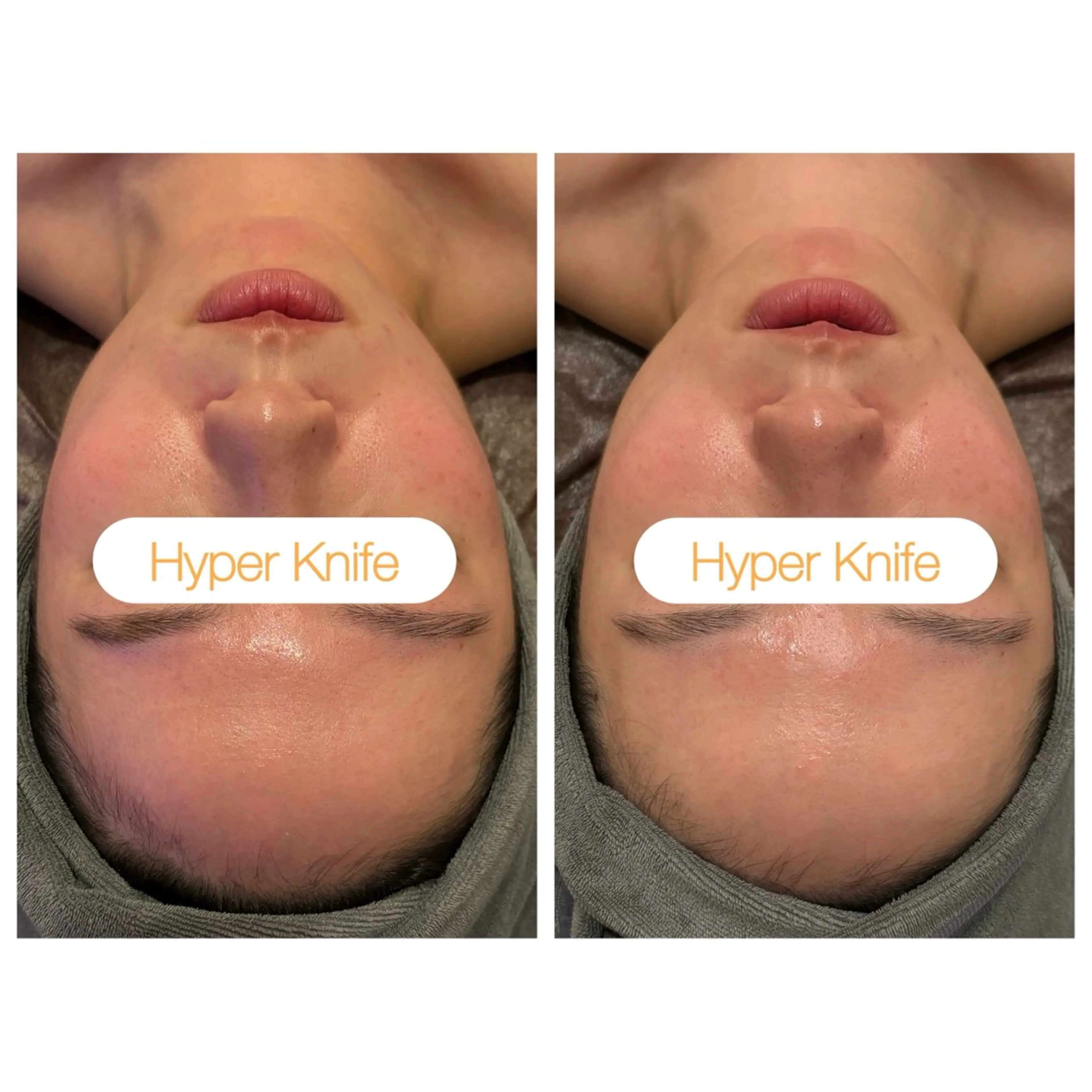 エステ リラク 小顔コルギ ☆表参道/外苑前のエステ・リラクイメージ