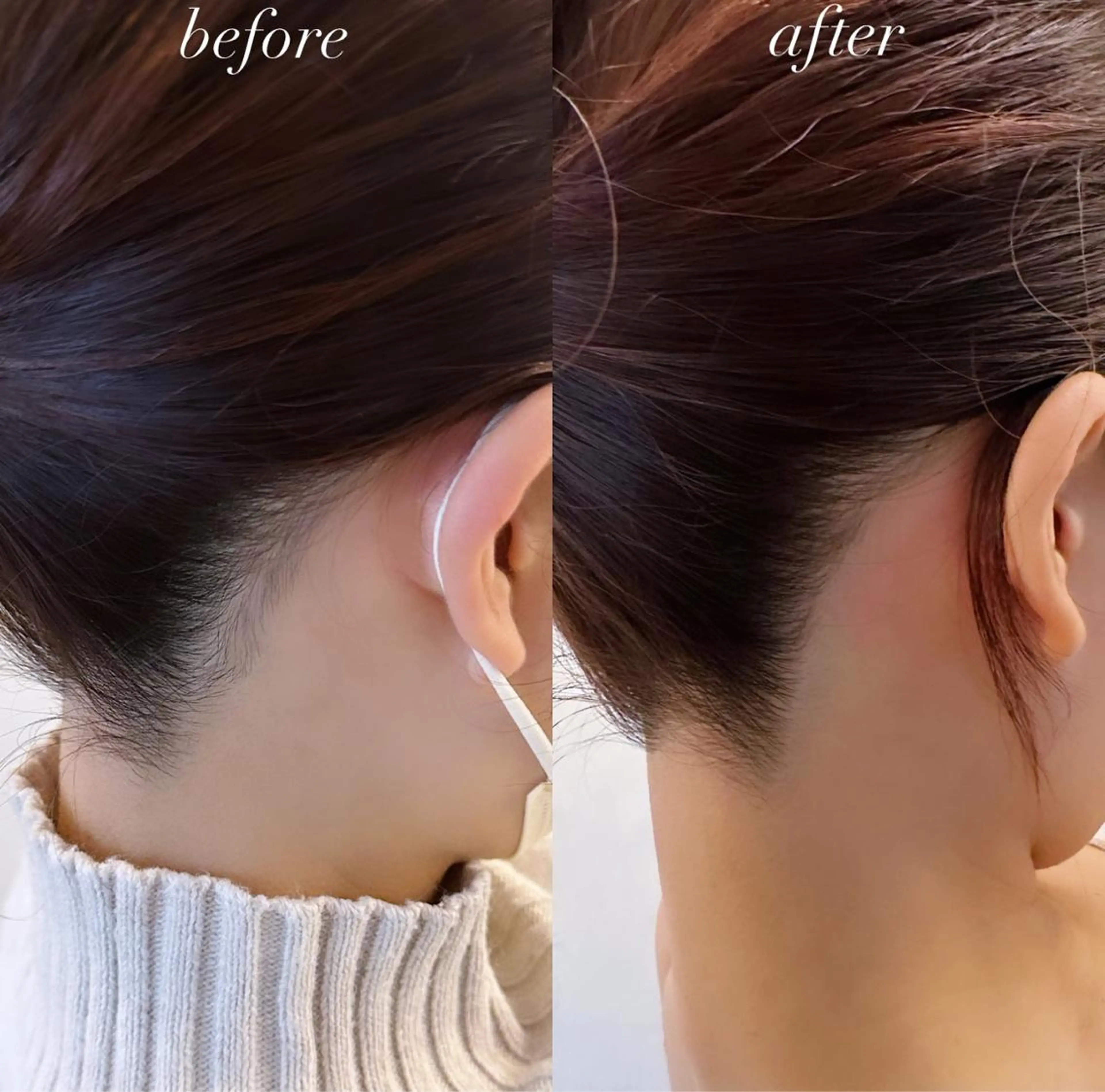 うなじ脱毛/美肌脱毛 LABELのエステ・リラクイメージ