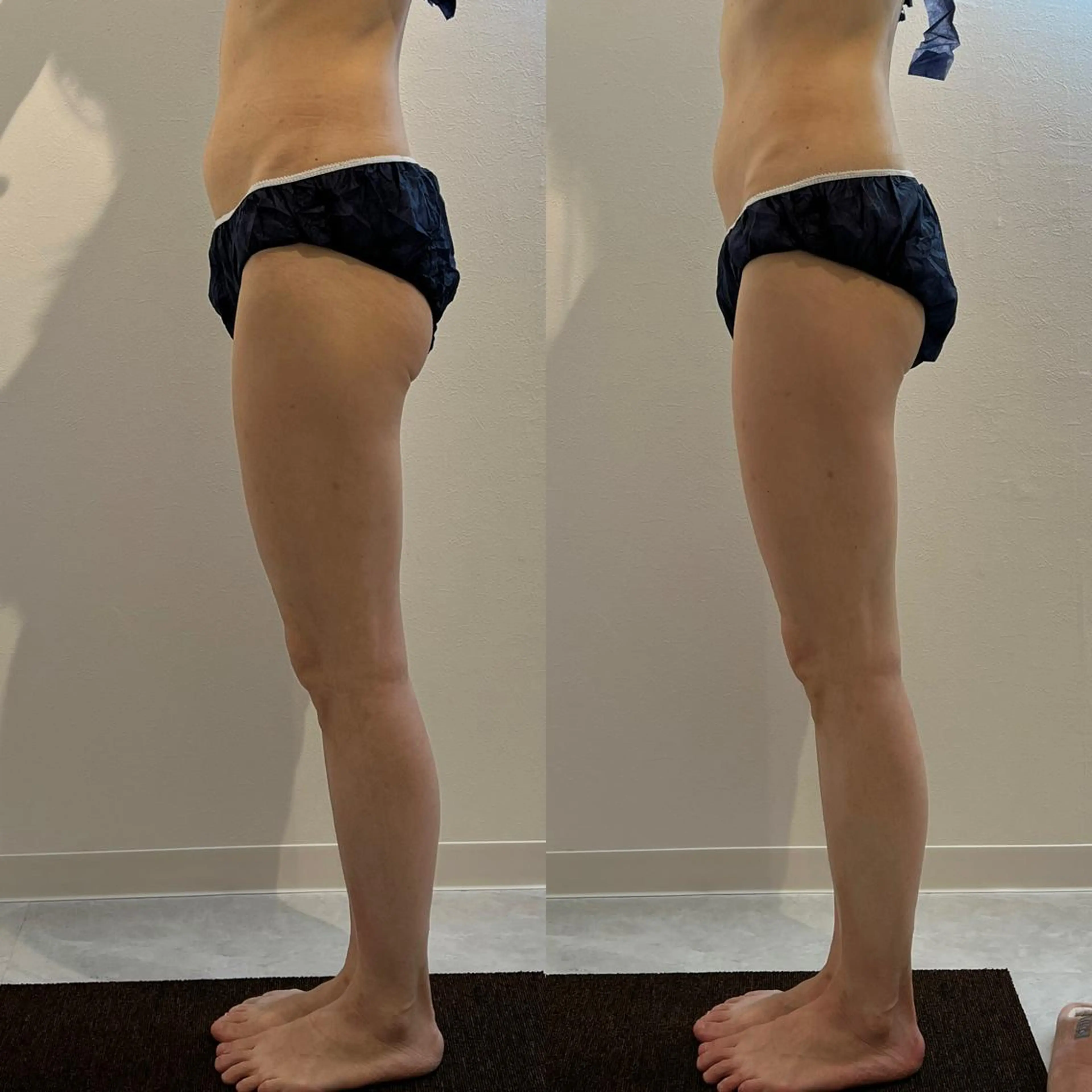 Reveur所属・Reveur REMIのエステ・リラクイメージ