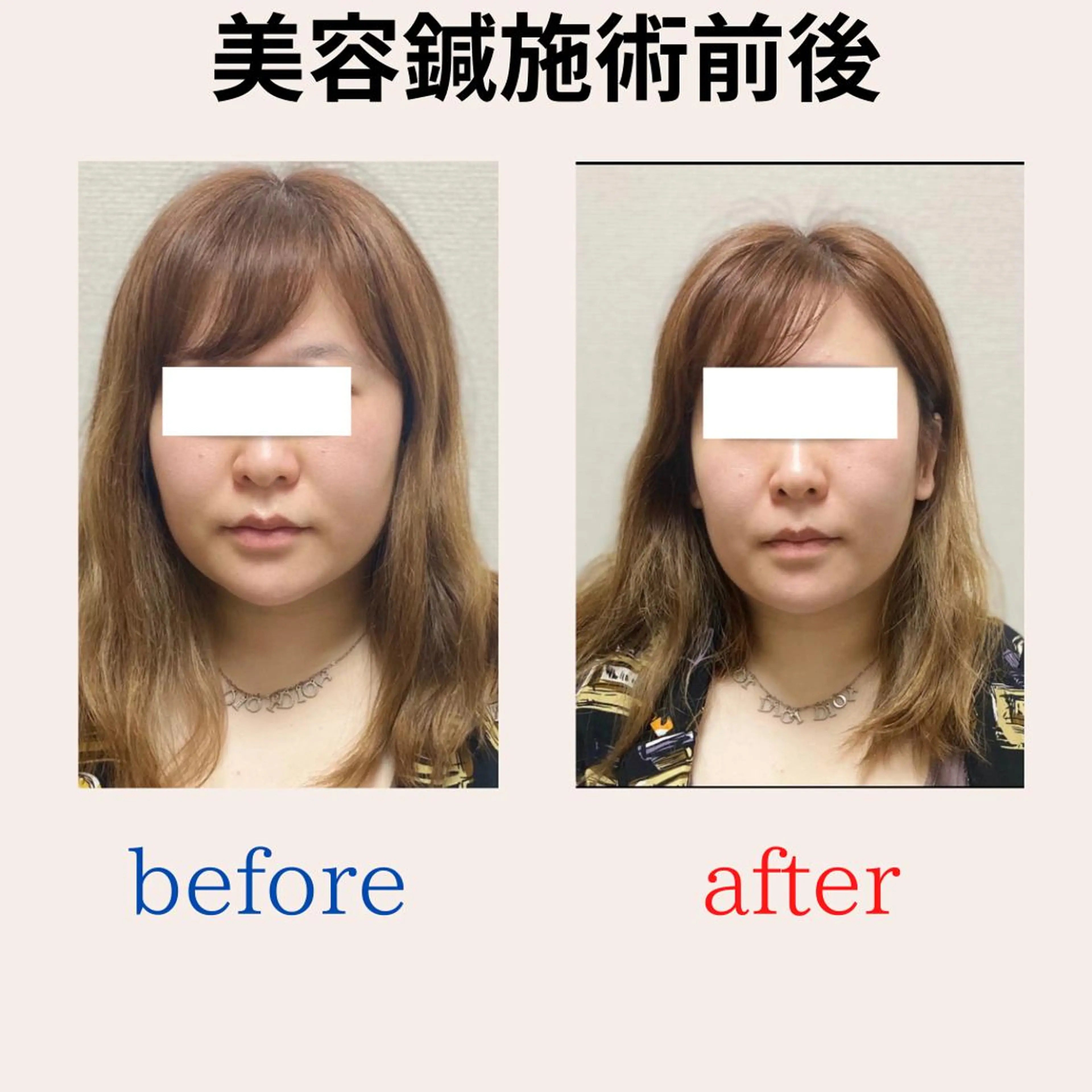 BEAUTY&HEALTH鍼灸院【春日部筋膜整体タケダ整体院】所属・武田 紘輝のエステ・リラクイメージ