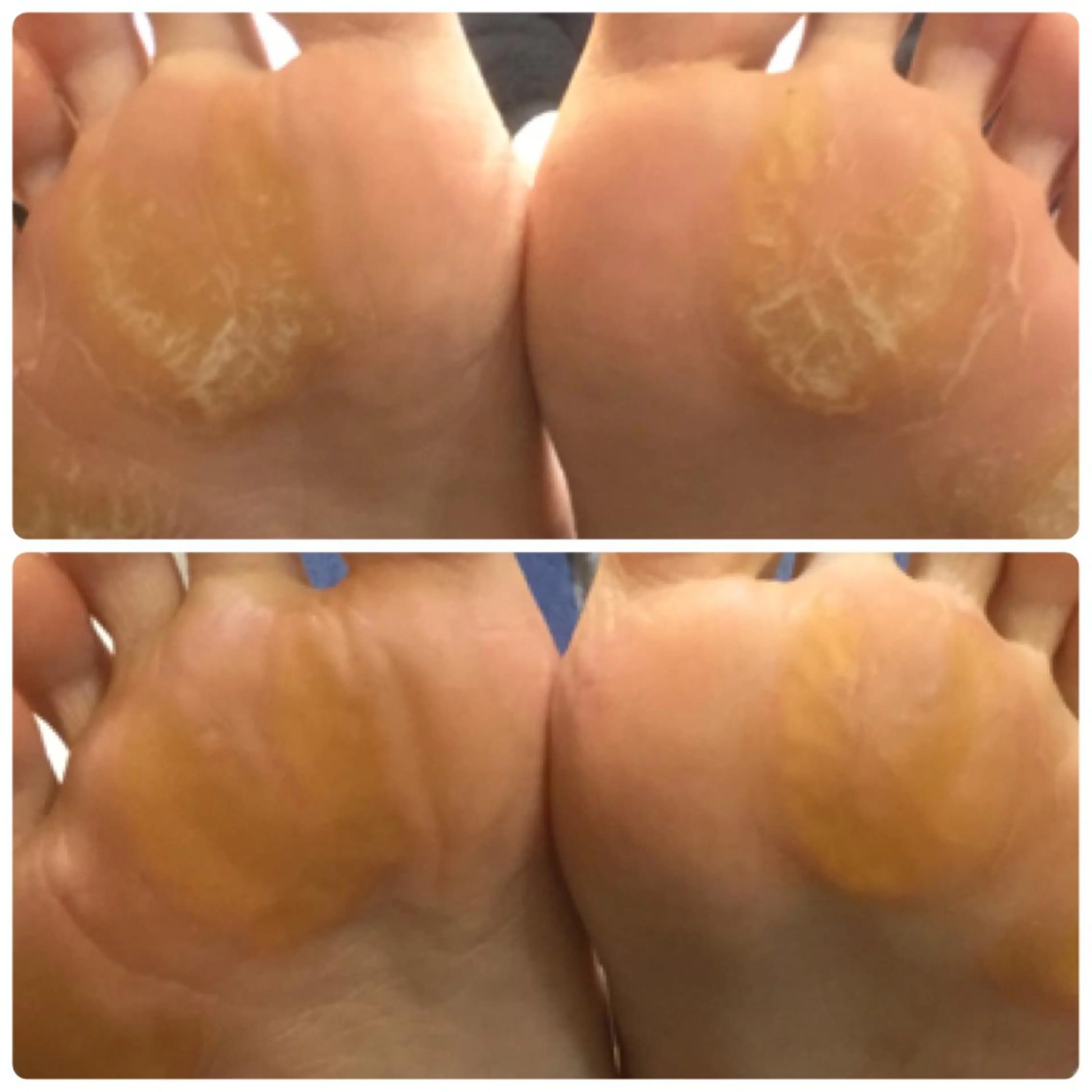 ネイル フットネイル & nudge nail所属・&nudgenail 本多のネイルデザイン