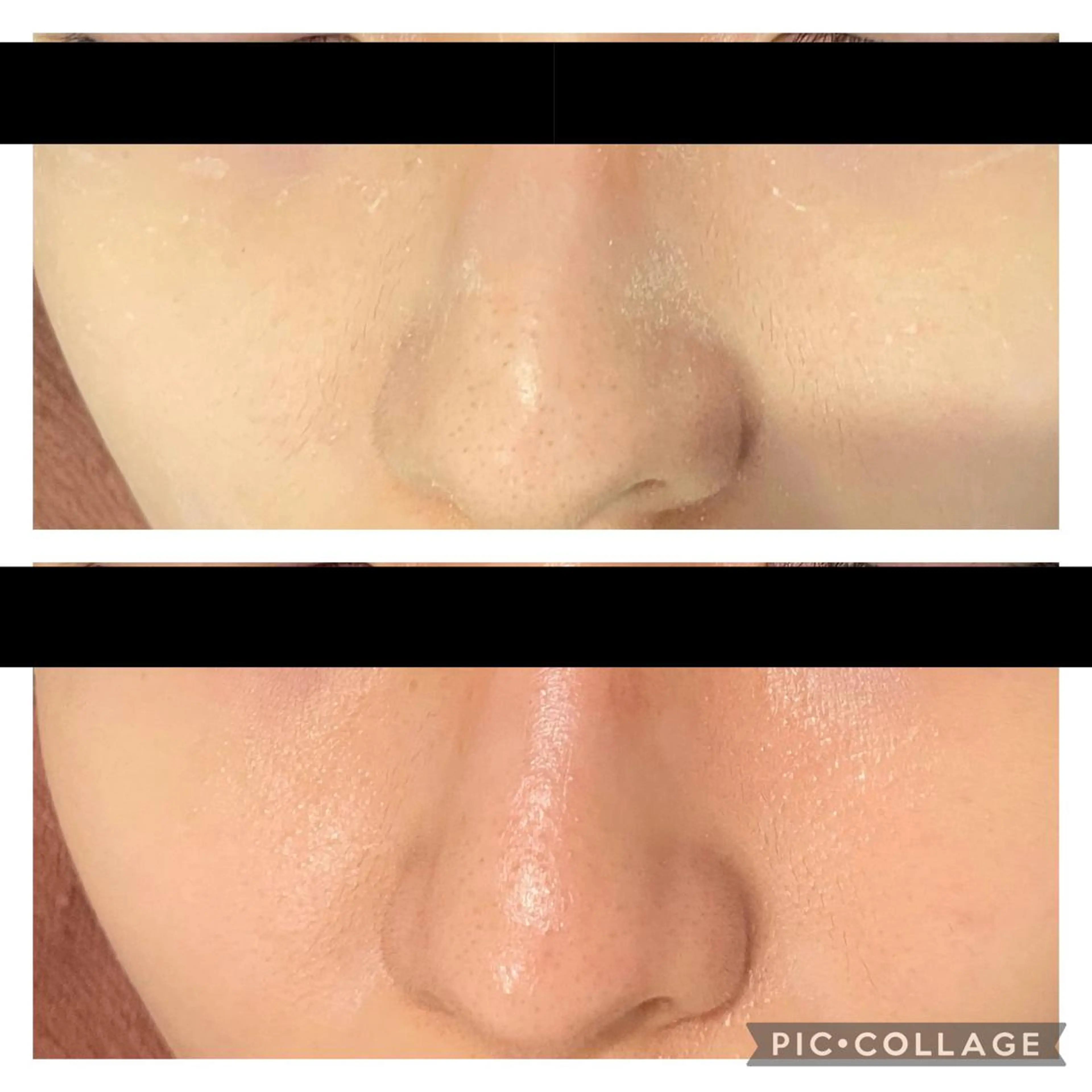 セミロング カラー パーマ ヘアアレンジ メンズ キッズ ネイル マツエク・マツパ アイブロウ ニキビ特化型エステ 🍋最短で肌質改善のエステ・リラクイメージ