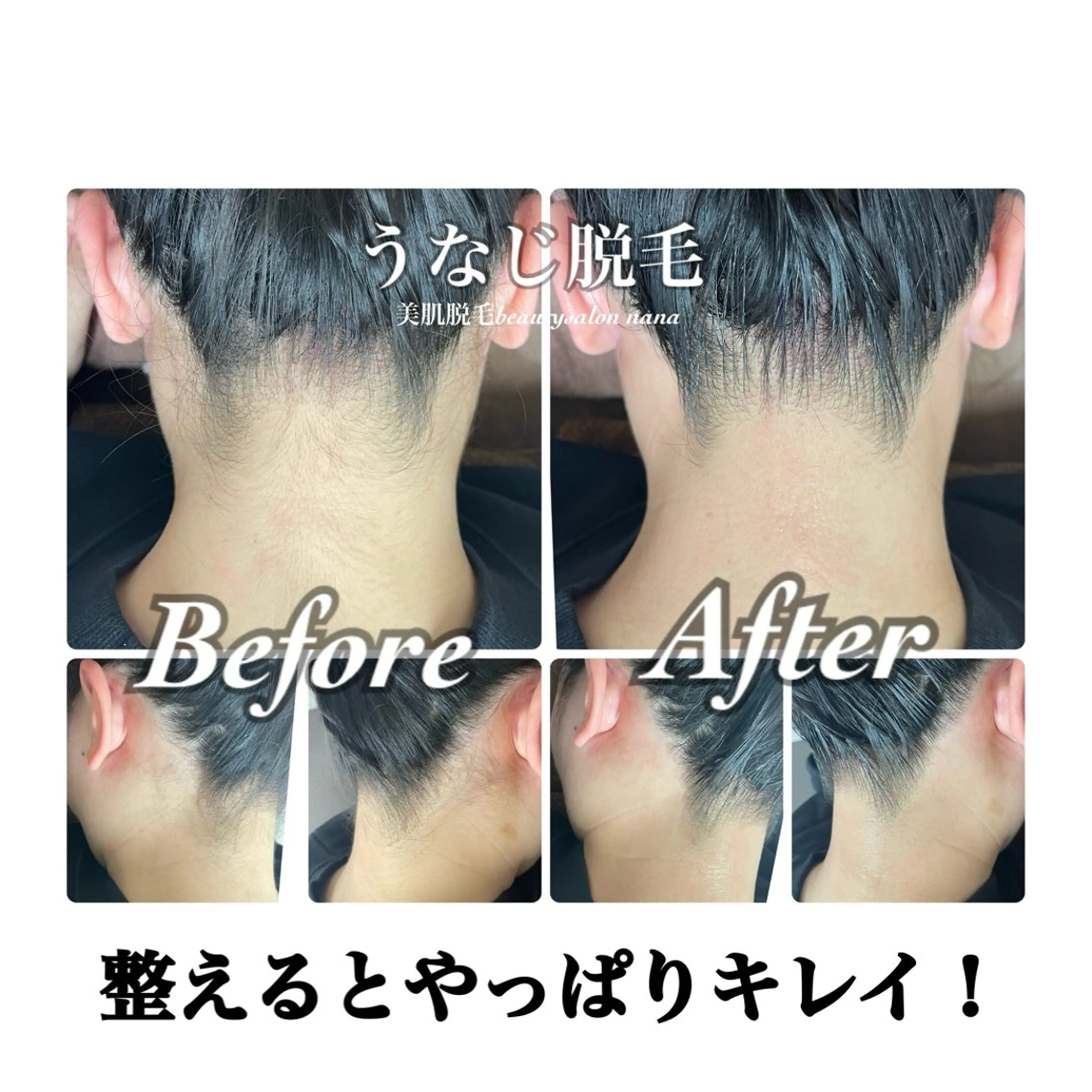 脱毛 beauty salon　nanaのエステ・リラクイメージ