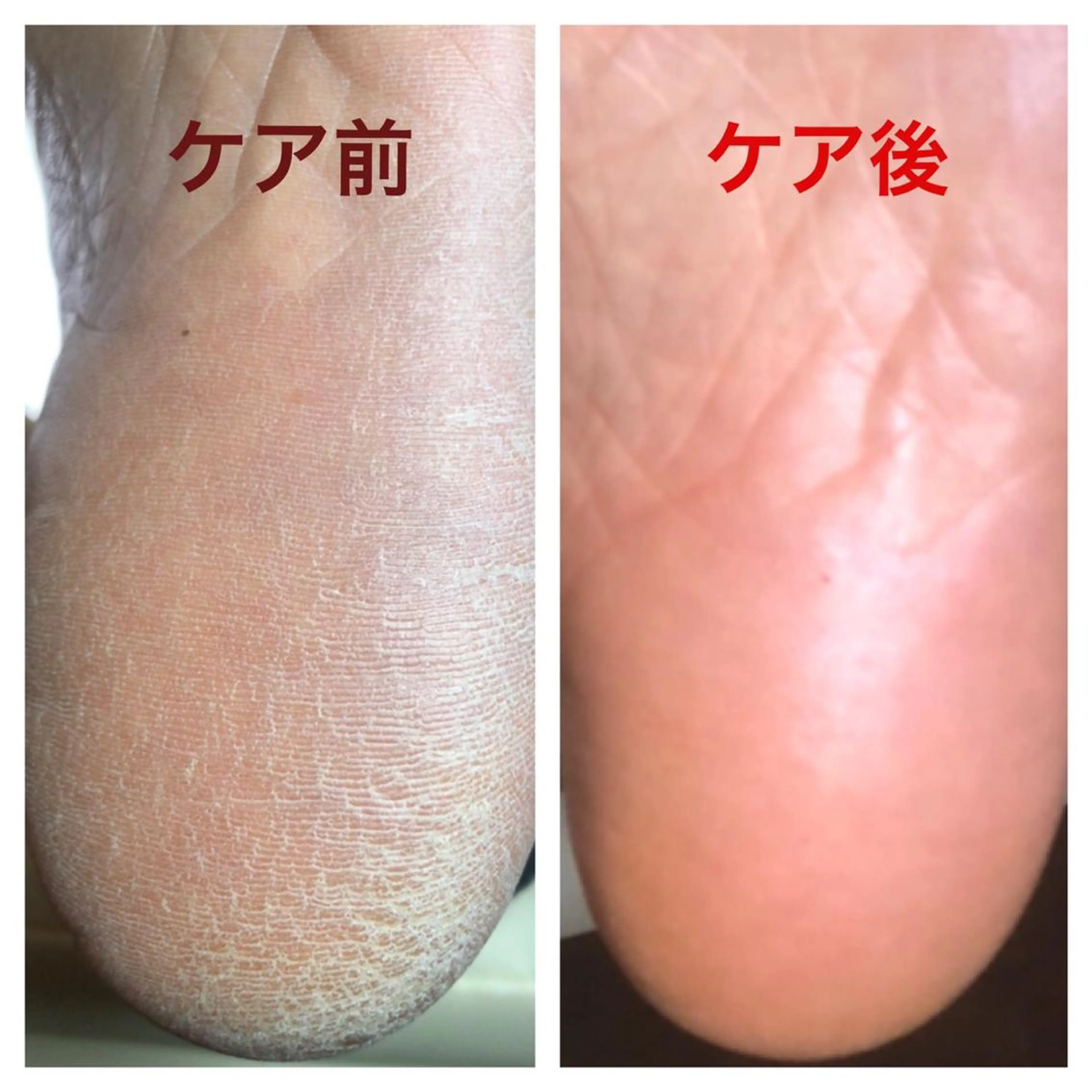ショート ネイル フットネイル 🌱 ま し お 🌱のエステ・リラクイメージ