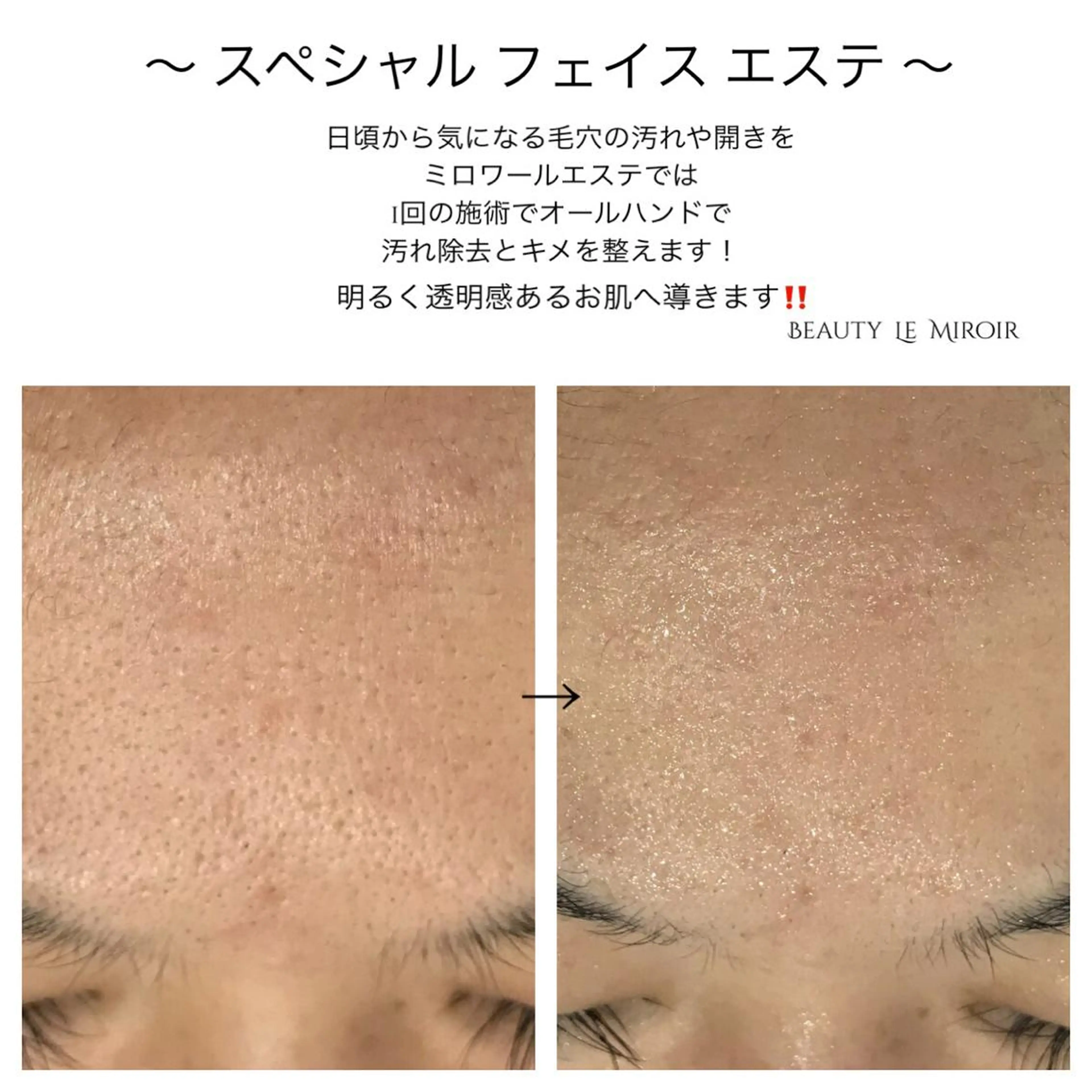 ビューティー ミロワールのエステ・リラクイメージ