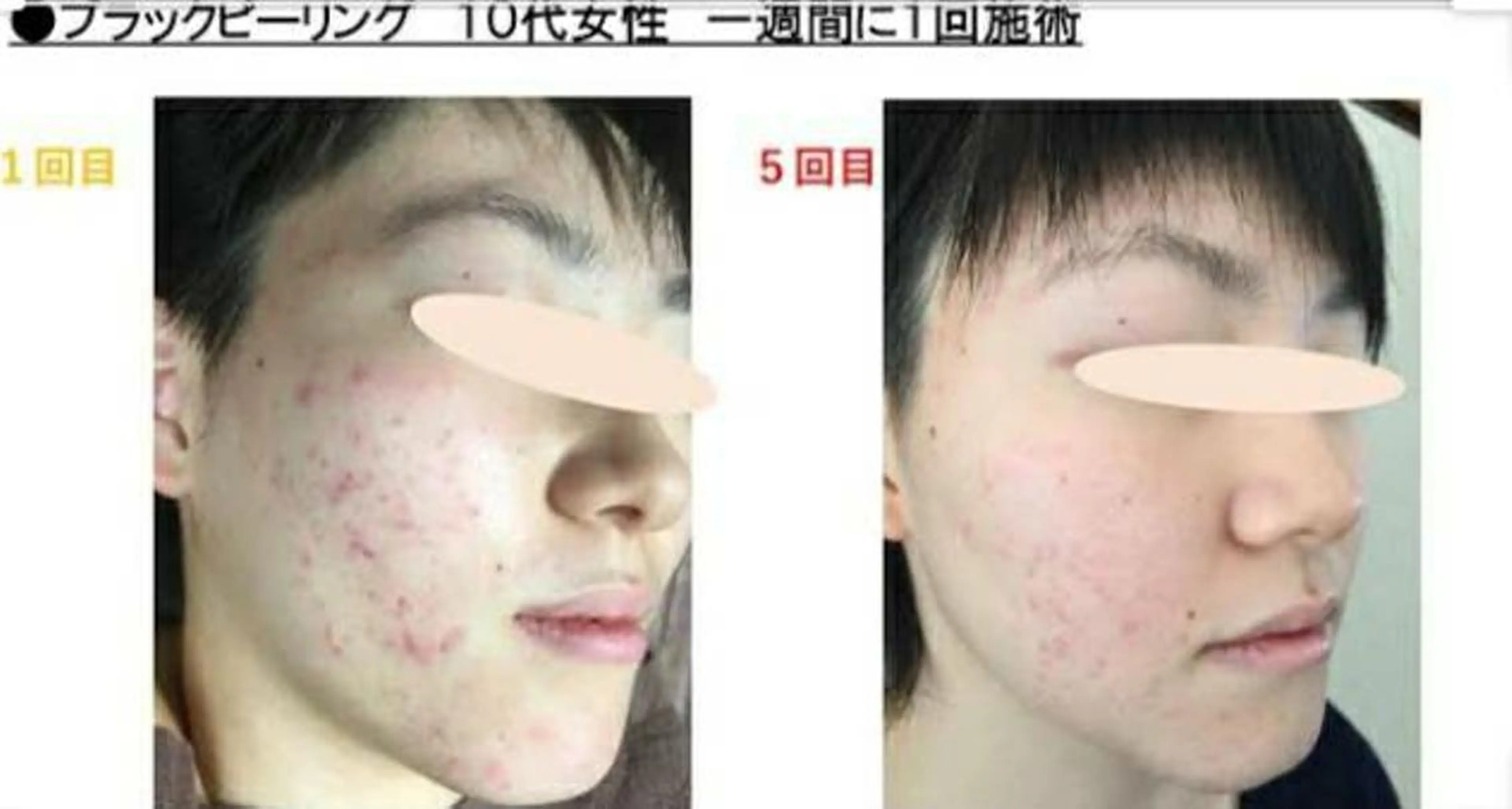 Salon pupa 店長のエステ・リラクイメージ