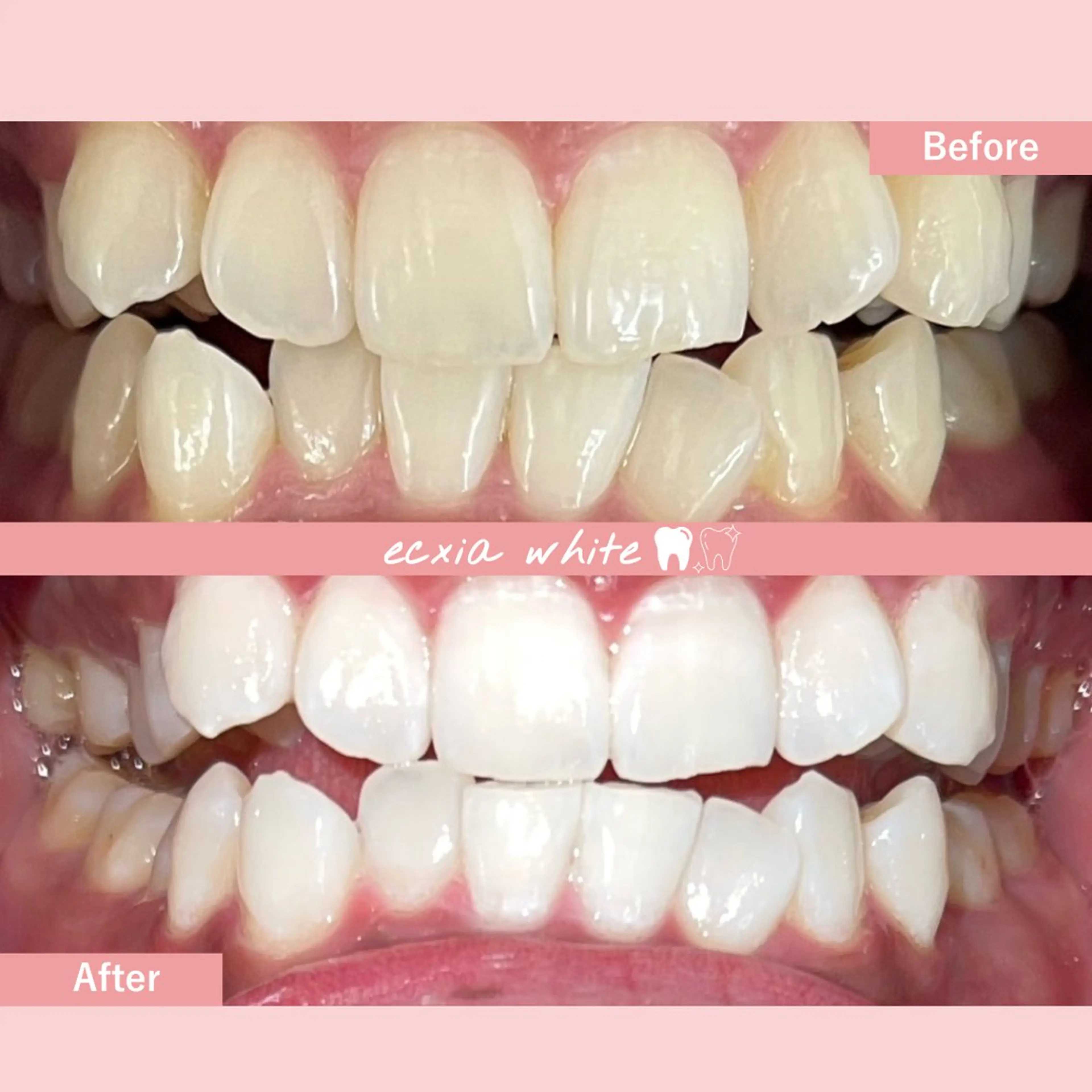 セルフホワイトニング エクシア札幌琴似店のその他イメージ