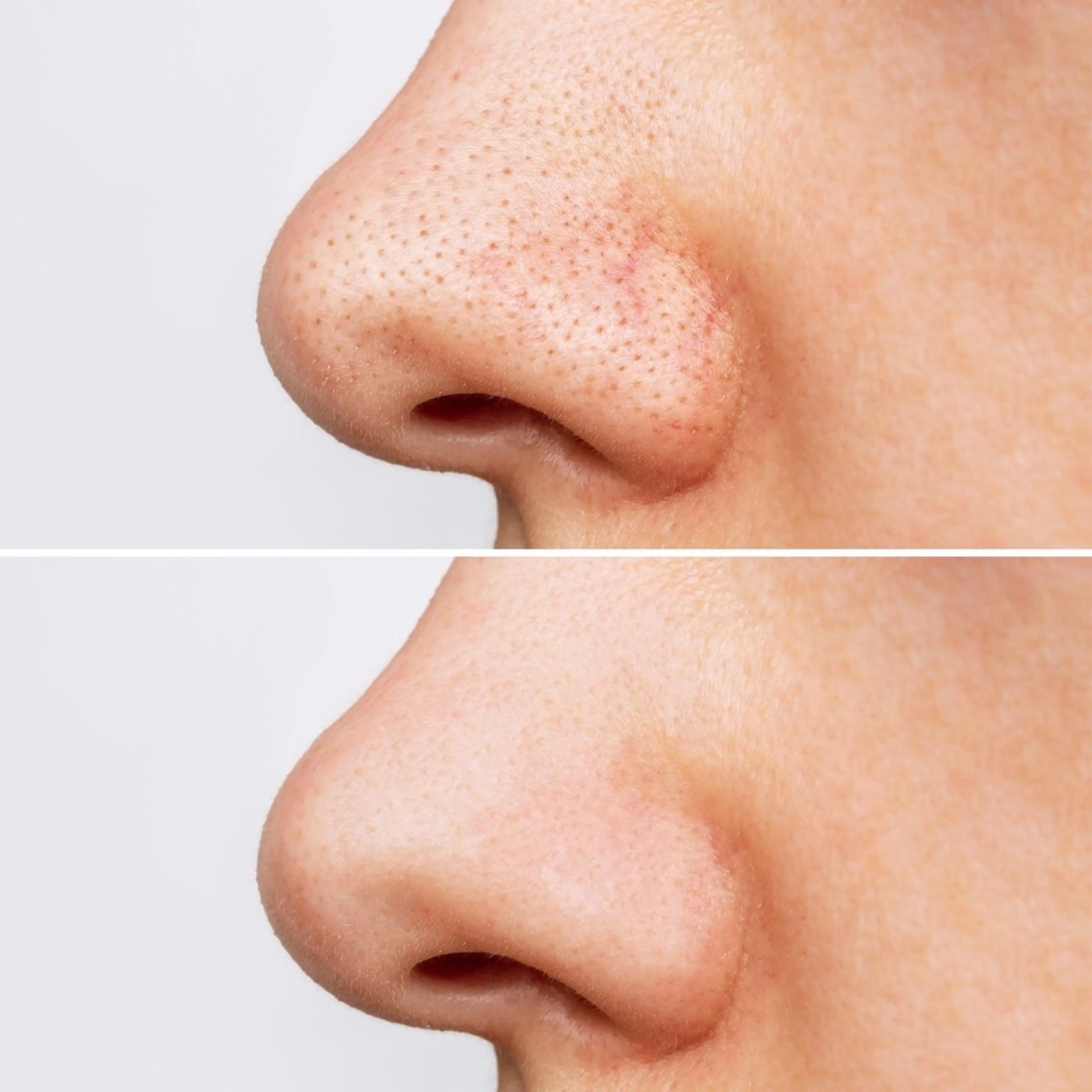 脱毛 【Diar】オーナー アキヨシケンタのヘアスタイル