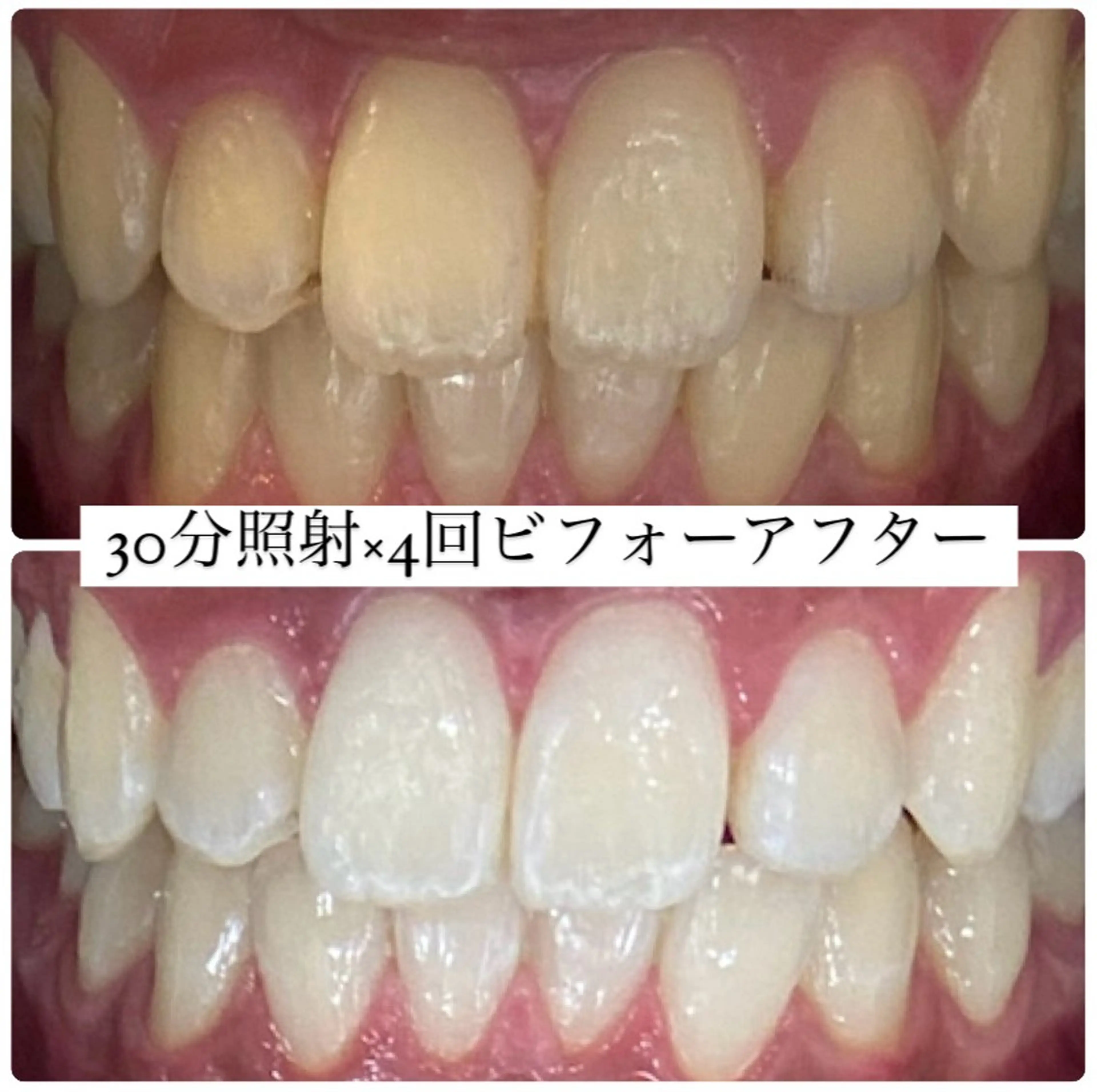 PLATINUM Beauty 横浜店所属・ホワイトニングルーム 横浜店のその他イメージ