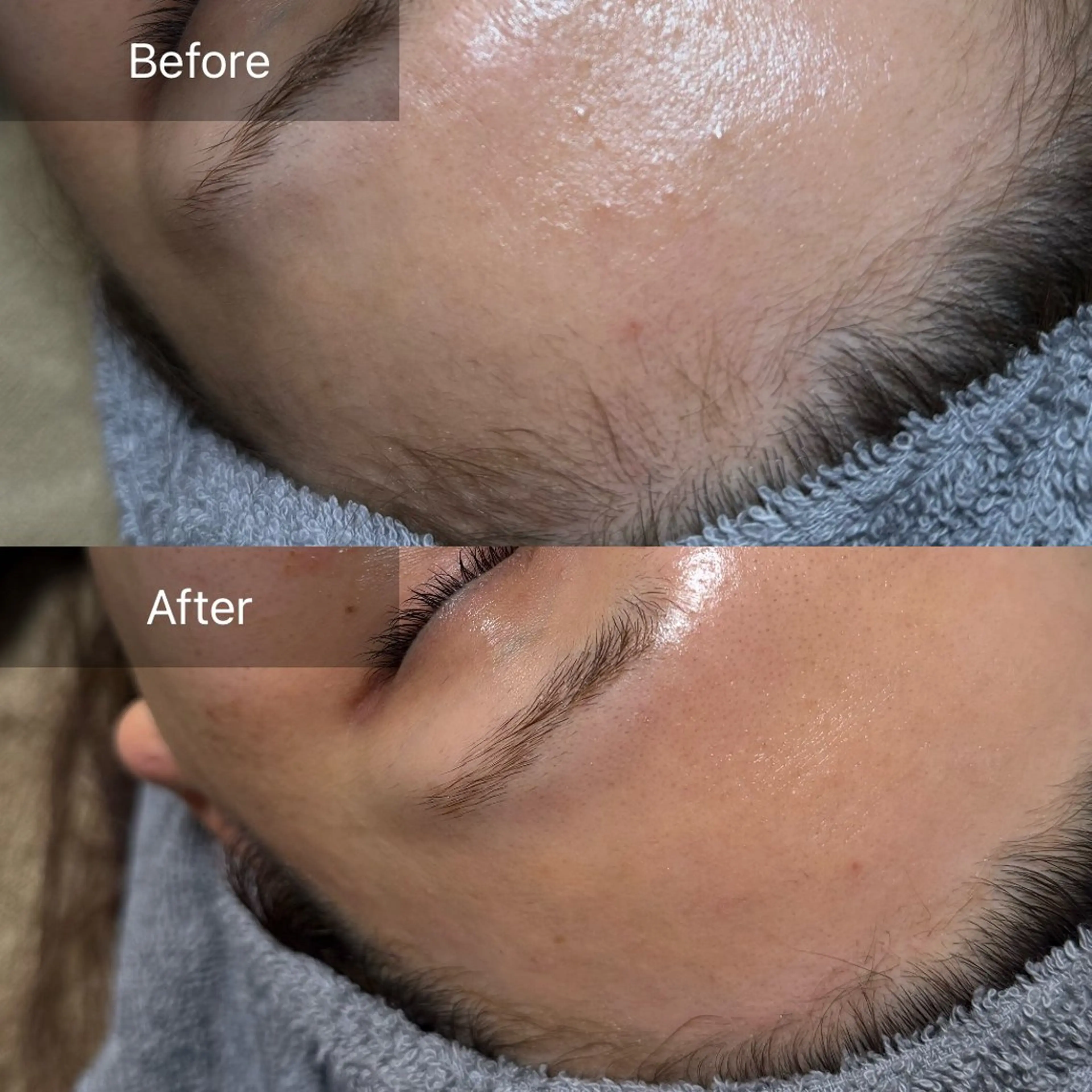 脱毛 enine フェイスWAXのエステ・リラクイメージ