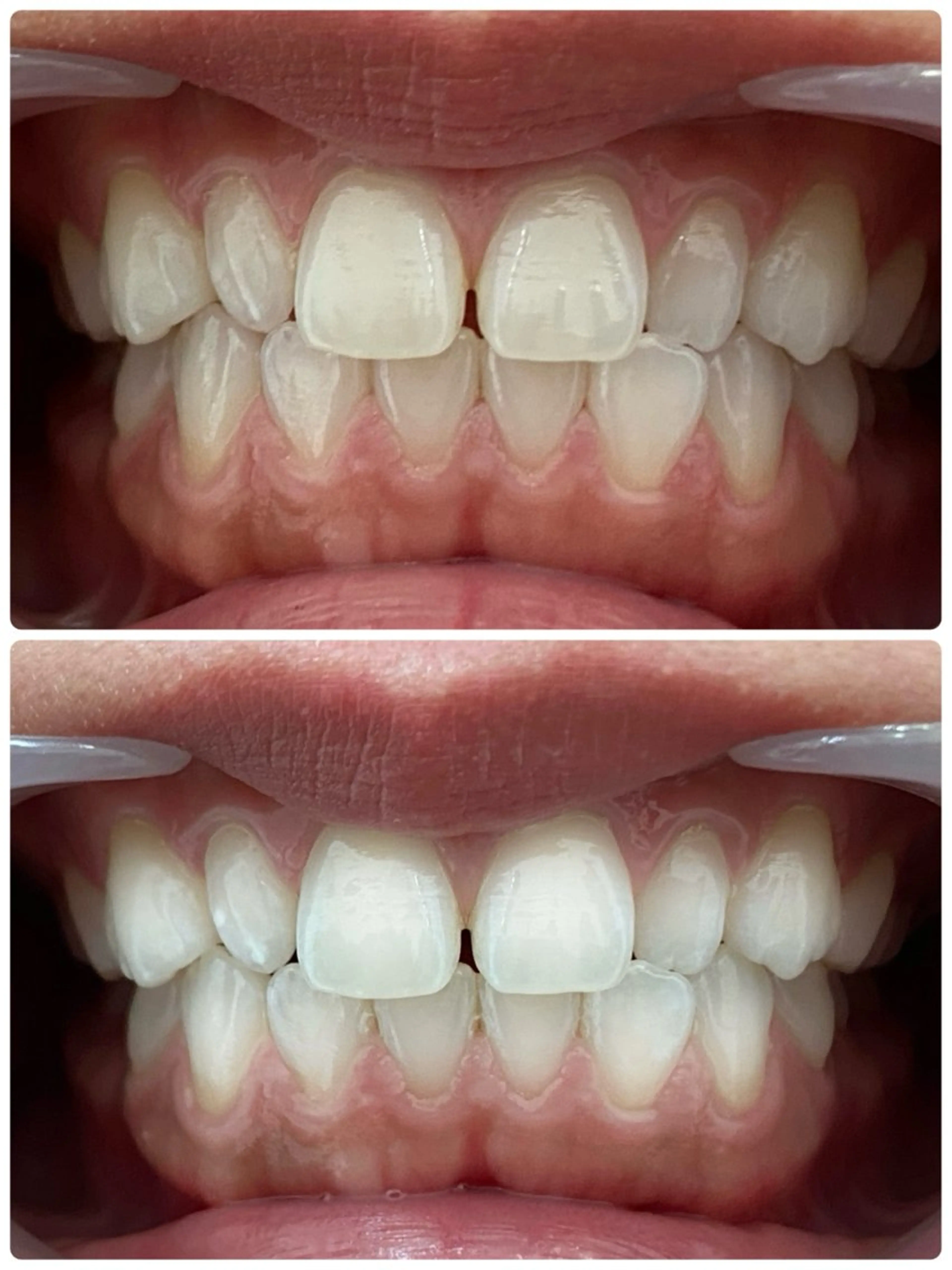 エステ ホワイトニングサロン Clear所属・ホワイトニングサロン Clearのエステ・リラクイメージ