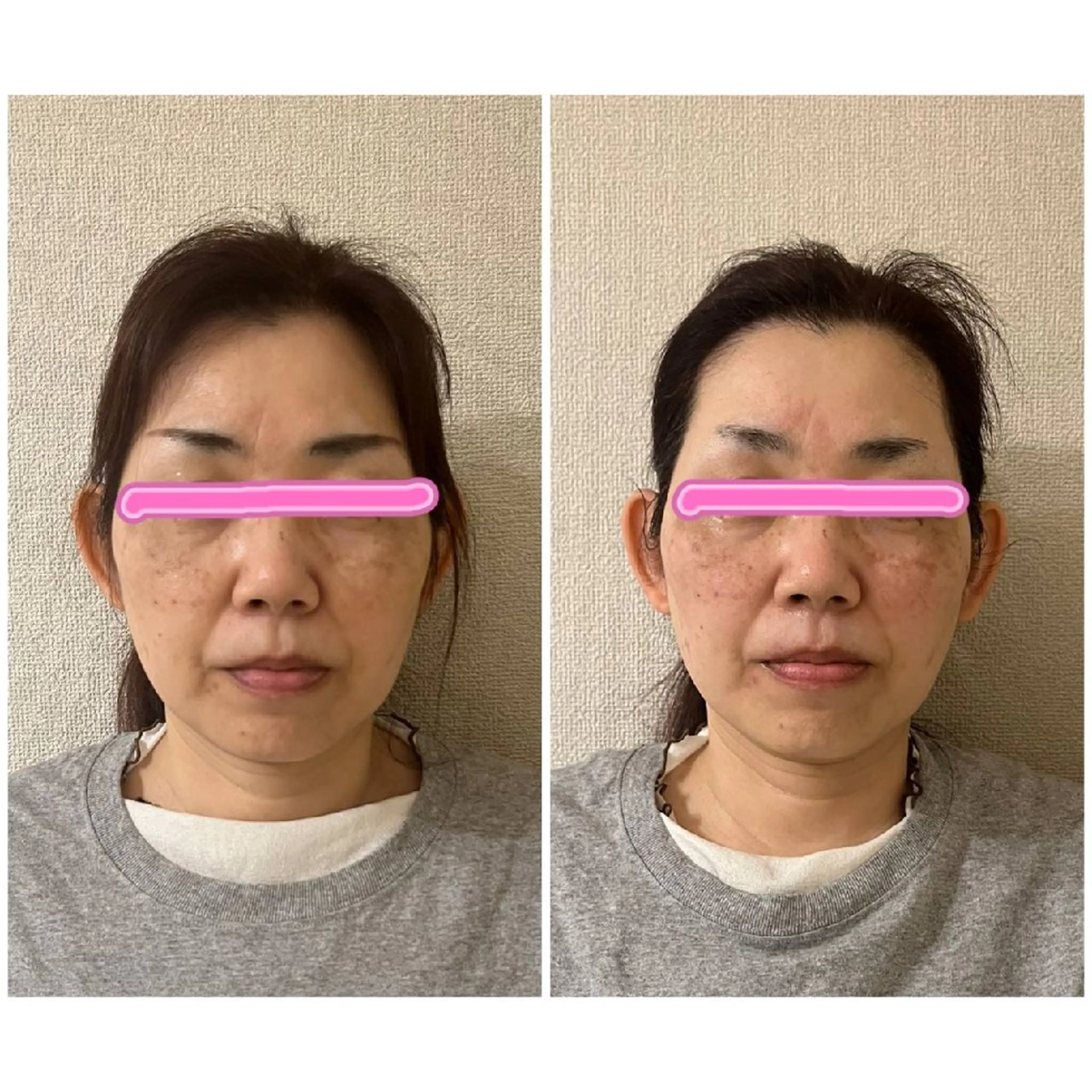 小顔エステsakura🌸belle(サクラベル)所属・小顔エステ サクラ🌸ベルのエステ・リラクイメージ