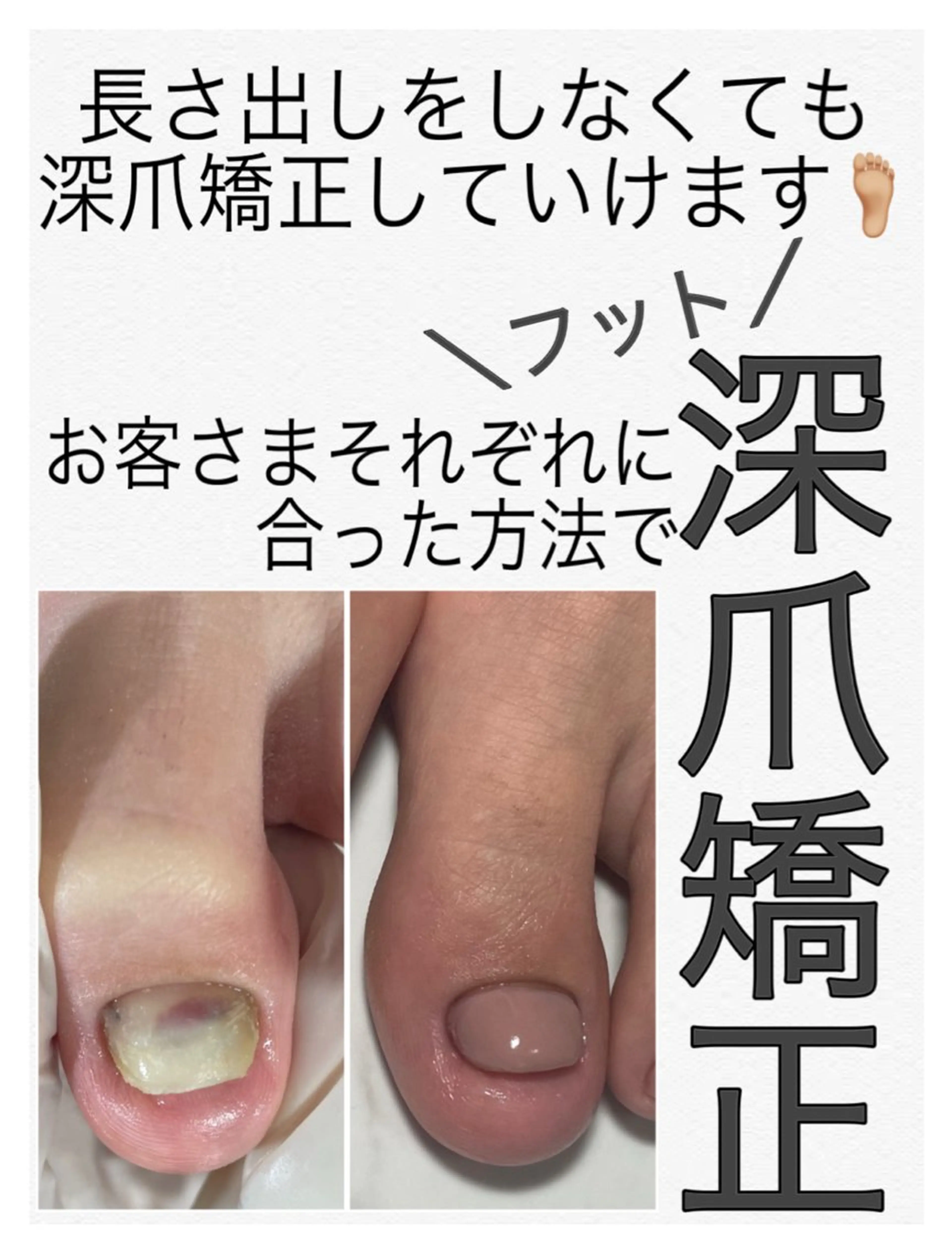 ネイル 長さ出し フットネイル nail salon petillantのネイルデザイン