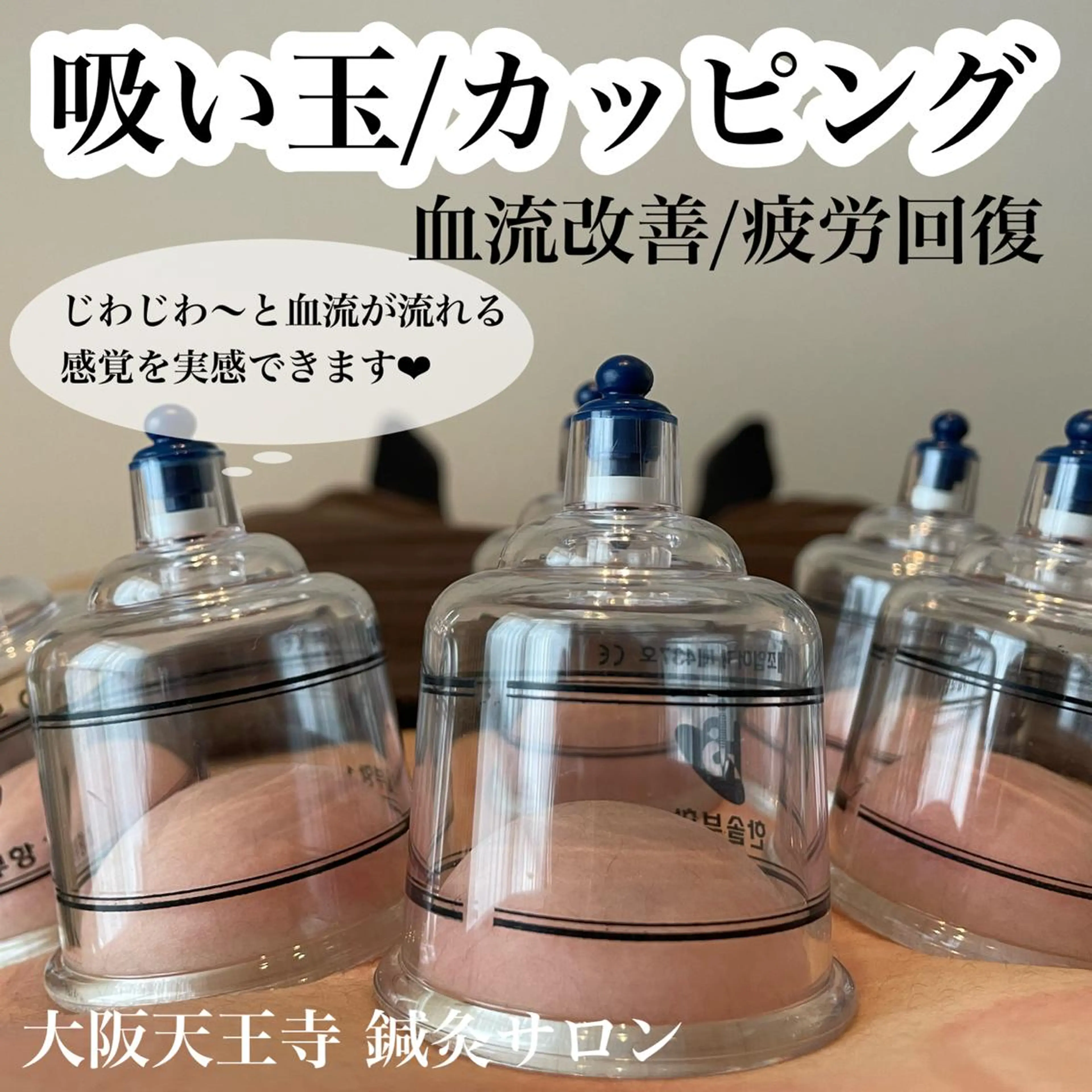 スライドカッピング(オイルトリートメント)背面/腹部/脚から1ヶ所の写真