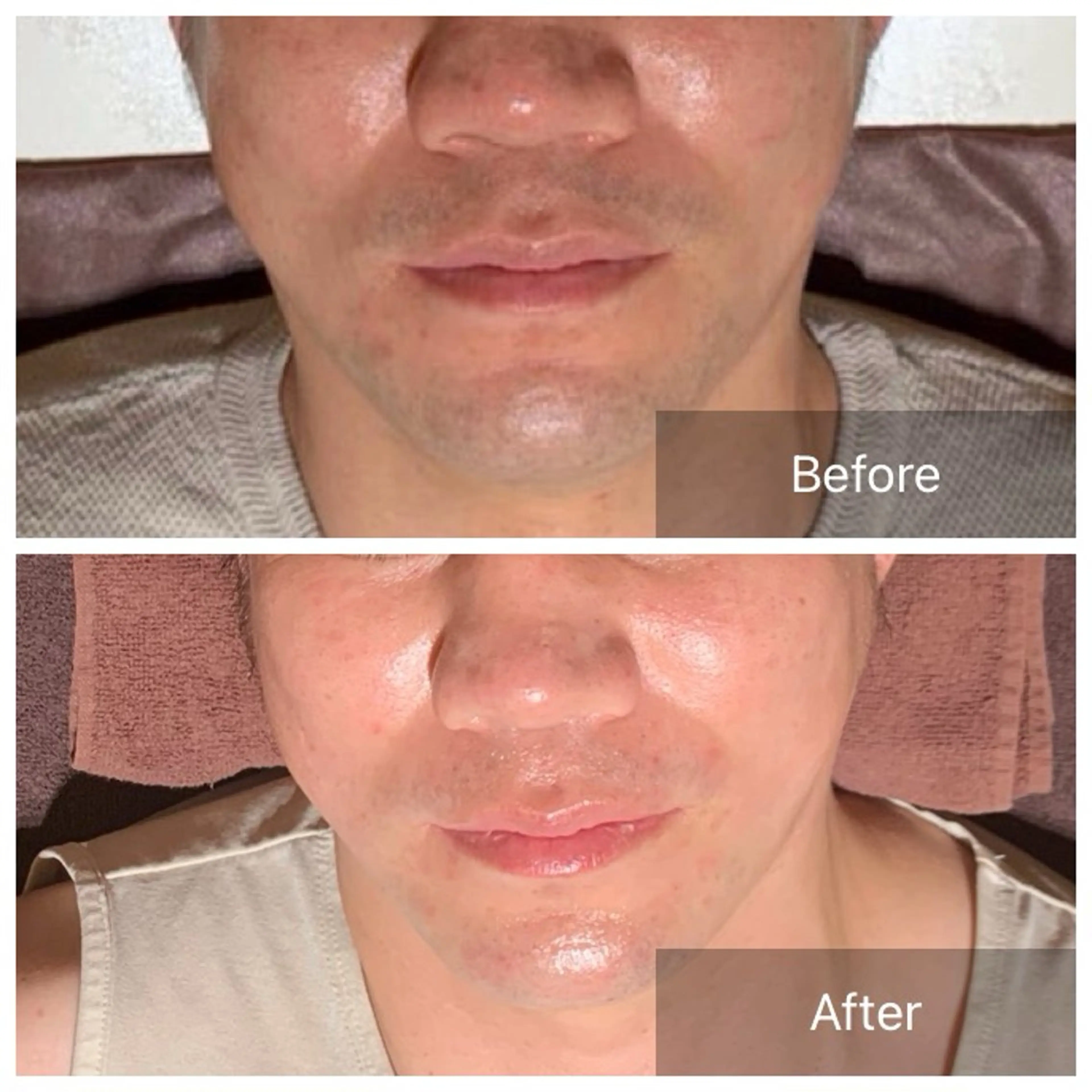 脱毛 実村💚BLEZE 毛穴/脱毛/痩身のエステ・リラクイメージ