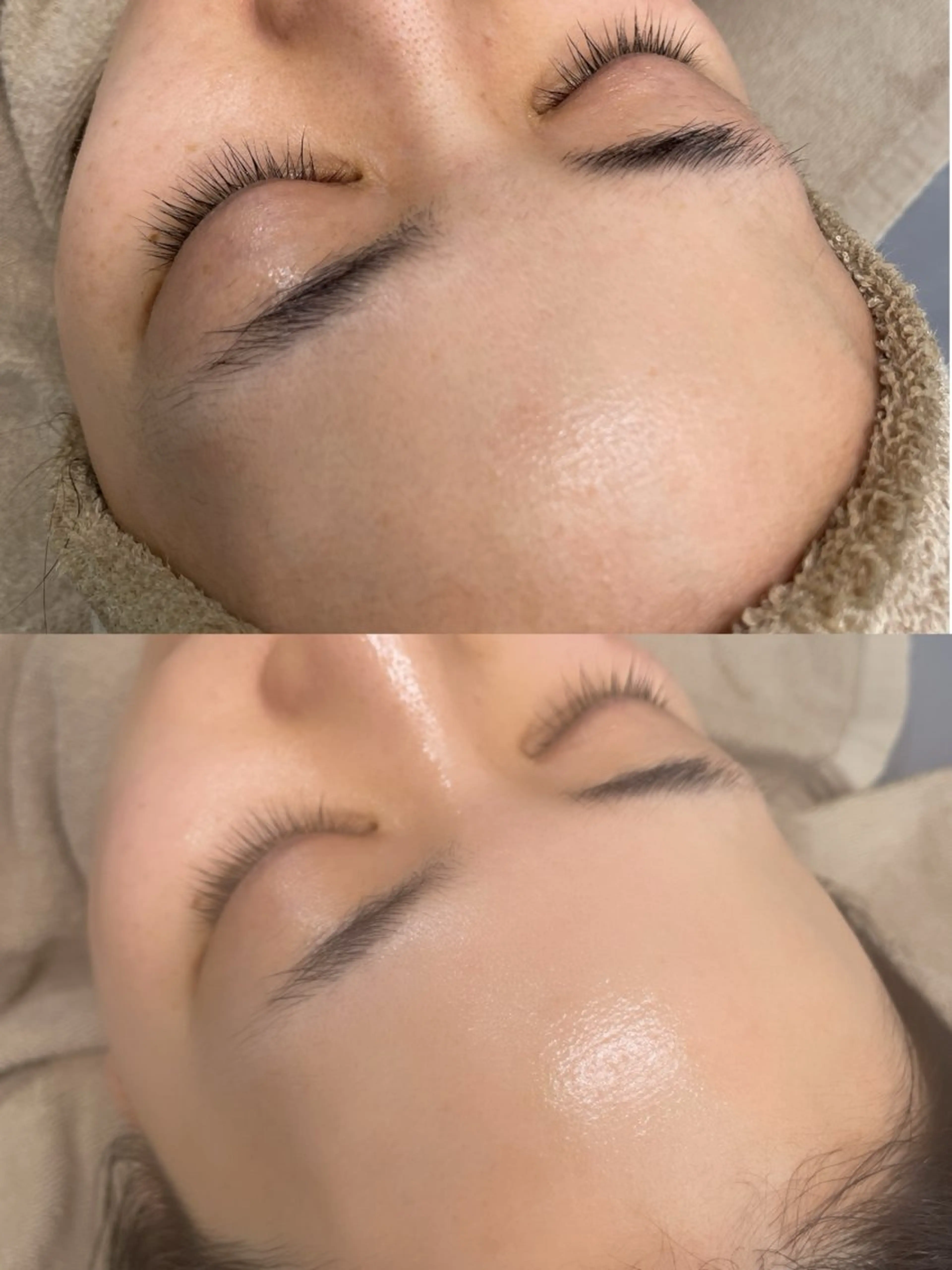 脱毛 ビューティーサロン Lino🫧mayuのエステ・リラクイメージ