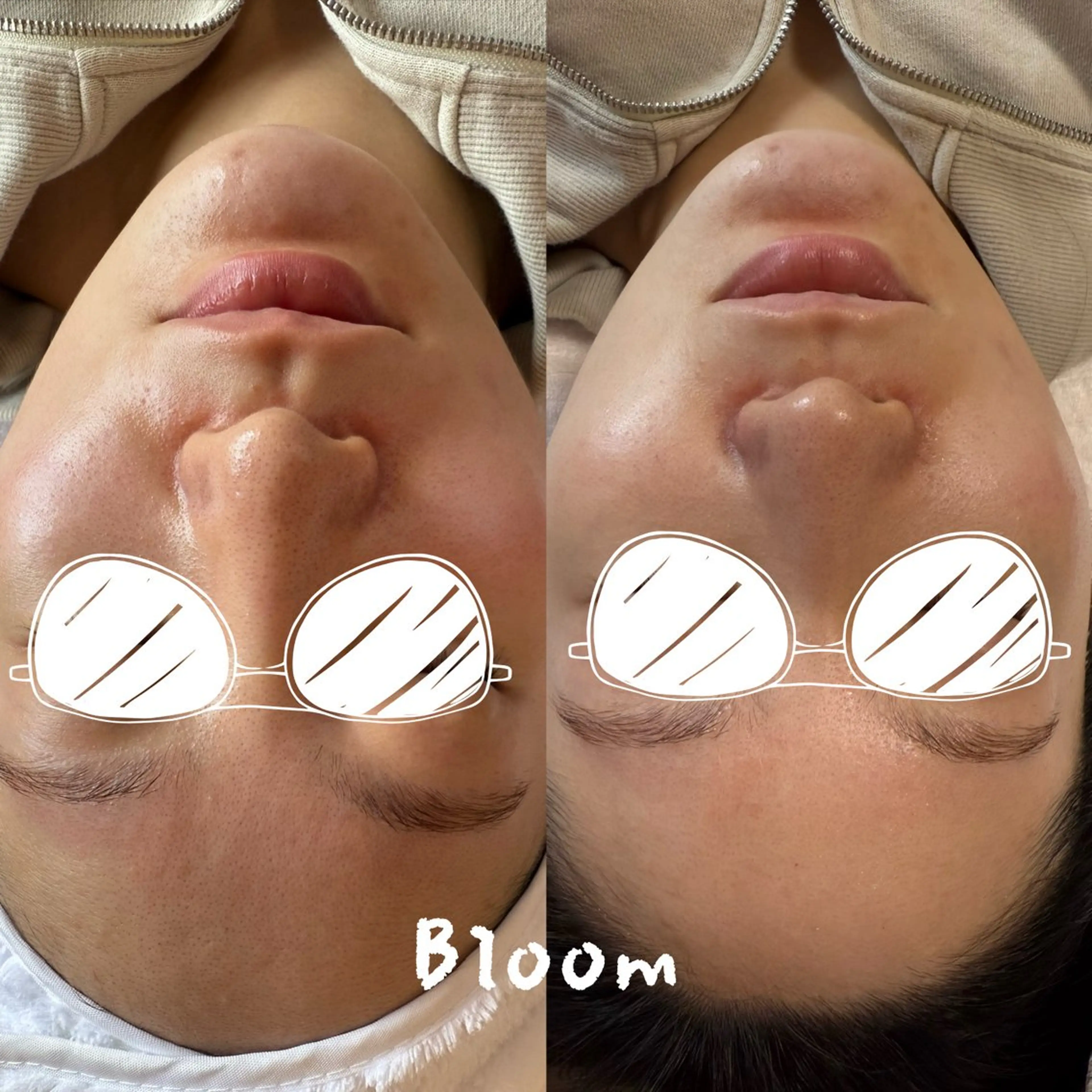 Bloom所属・ネイル＆フェイシャル Bloomのエステ・リラクイメージ