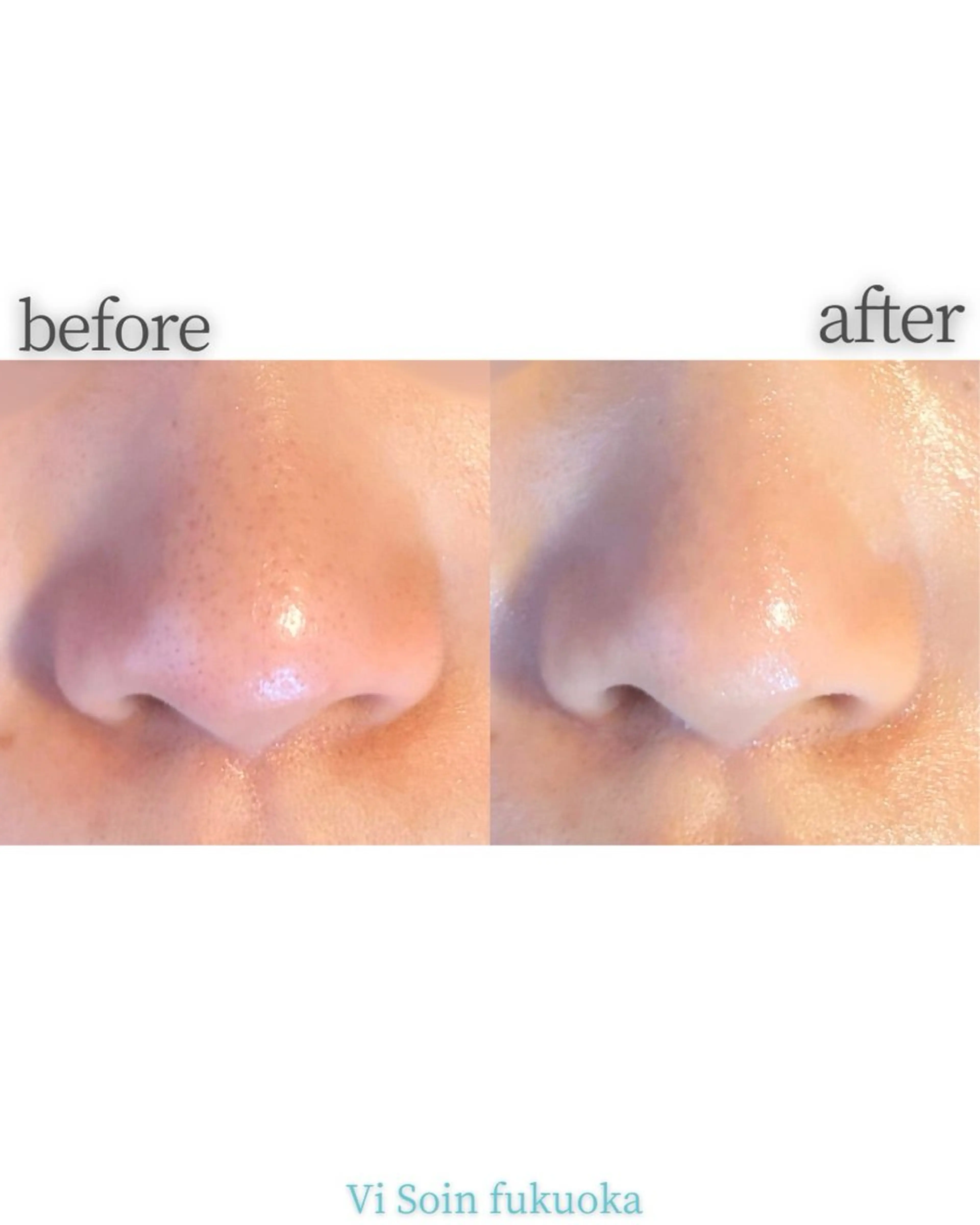 ソワン所属・脱毛 フェイシャル soin~ソワン~のエステ・リラクイメージ