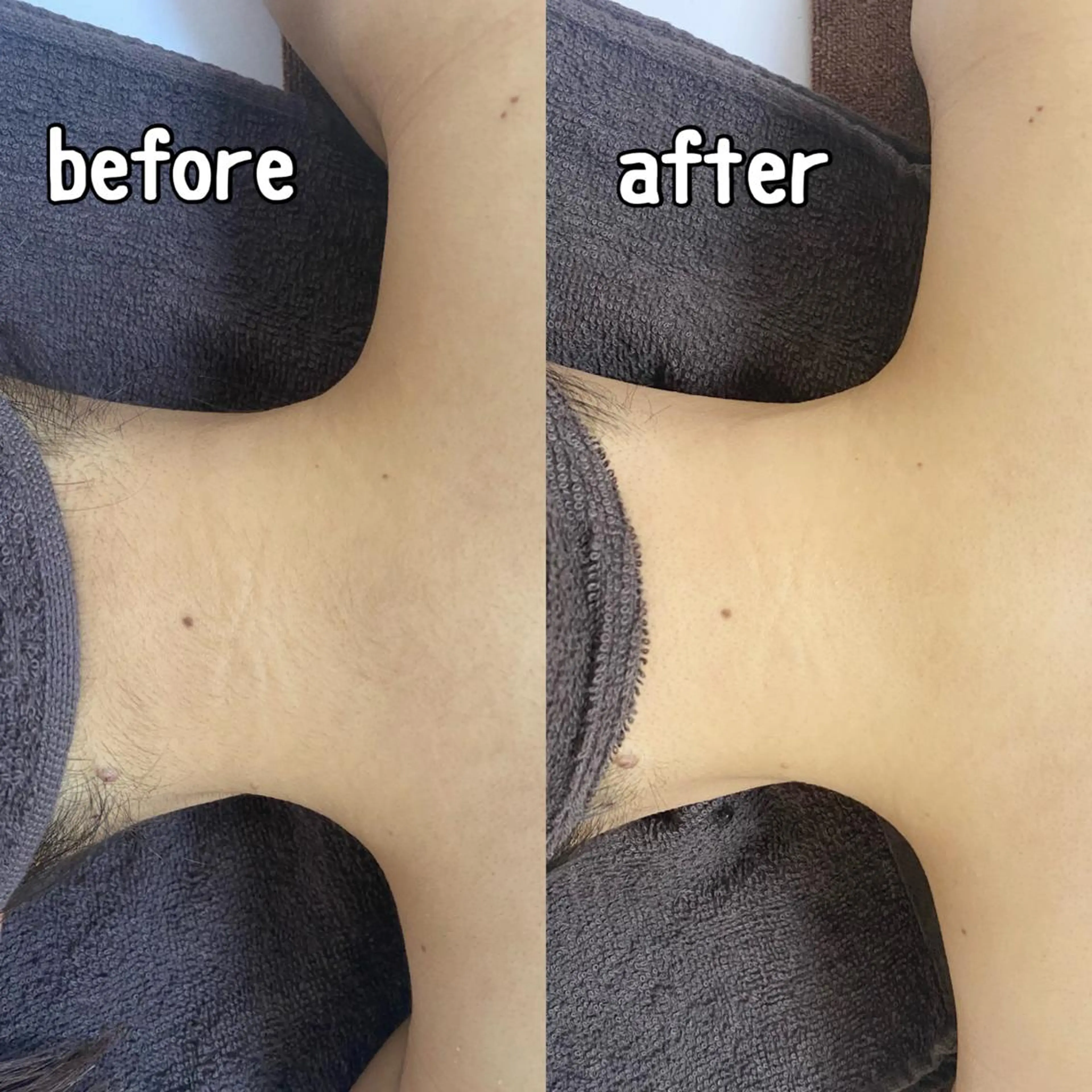 脱毛 Be Charm 山﨑のエステ・リラクイメージ