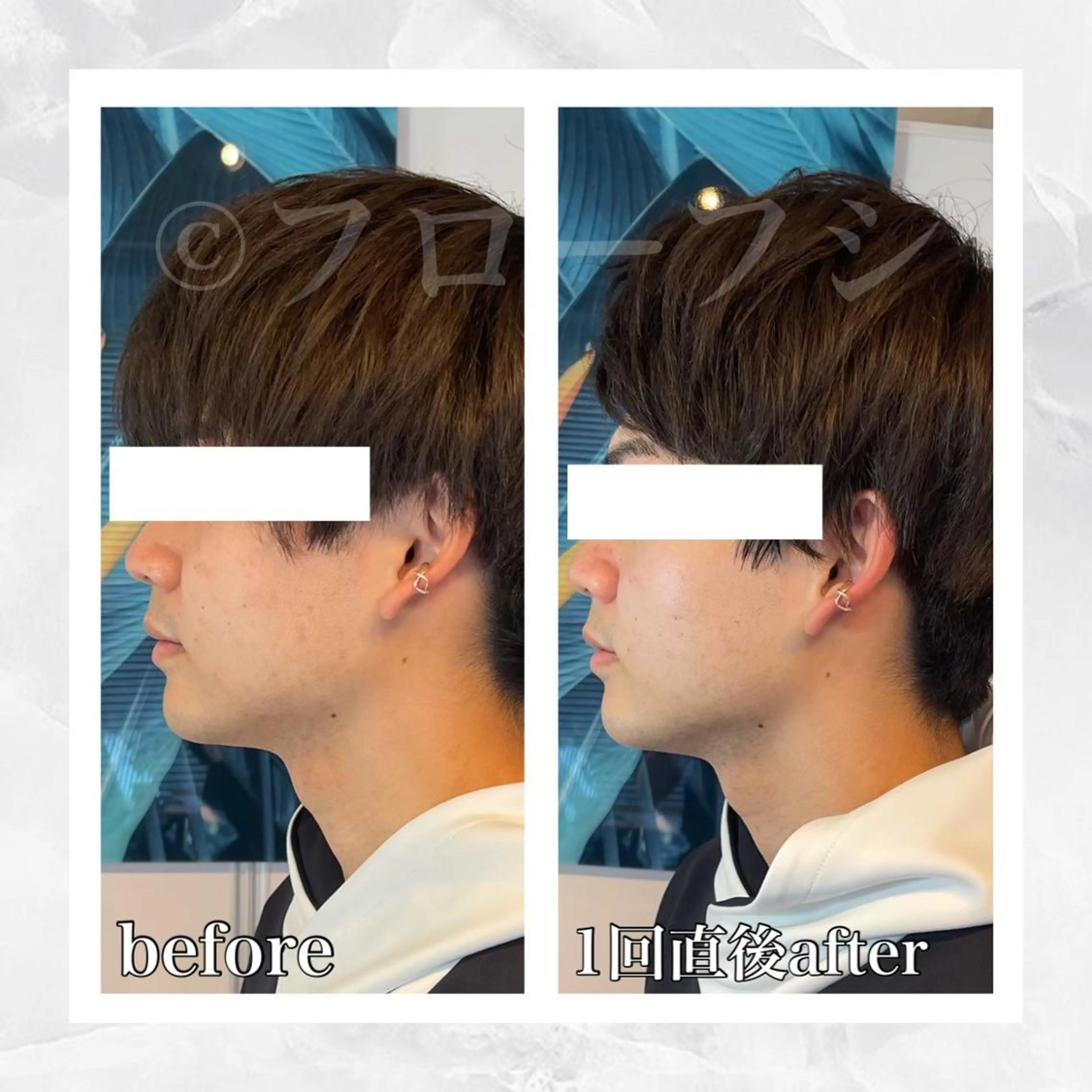 エステ リラク 部分痩せ♥️小顔専門 MIKUのエステ・リラクイメージ