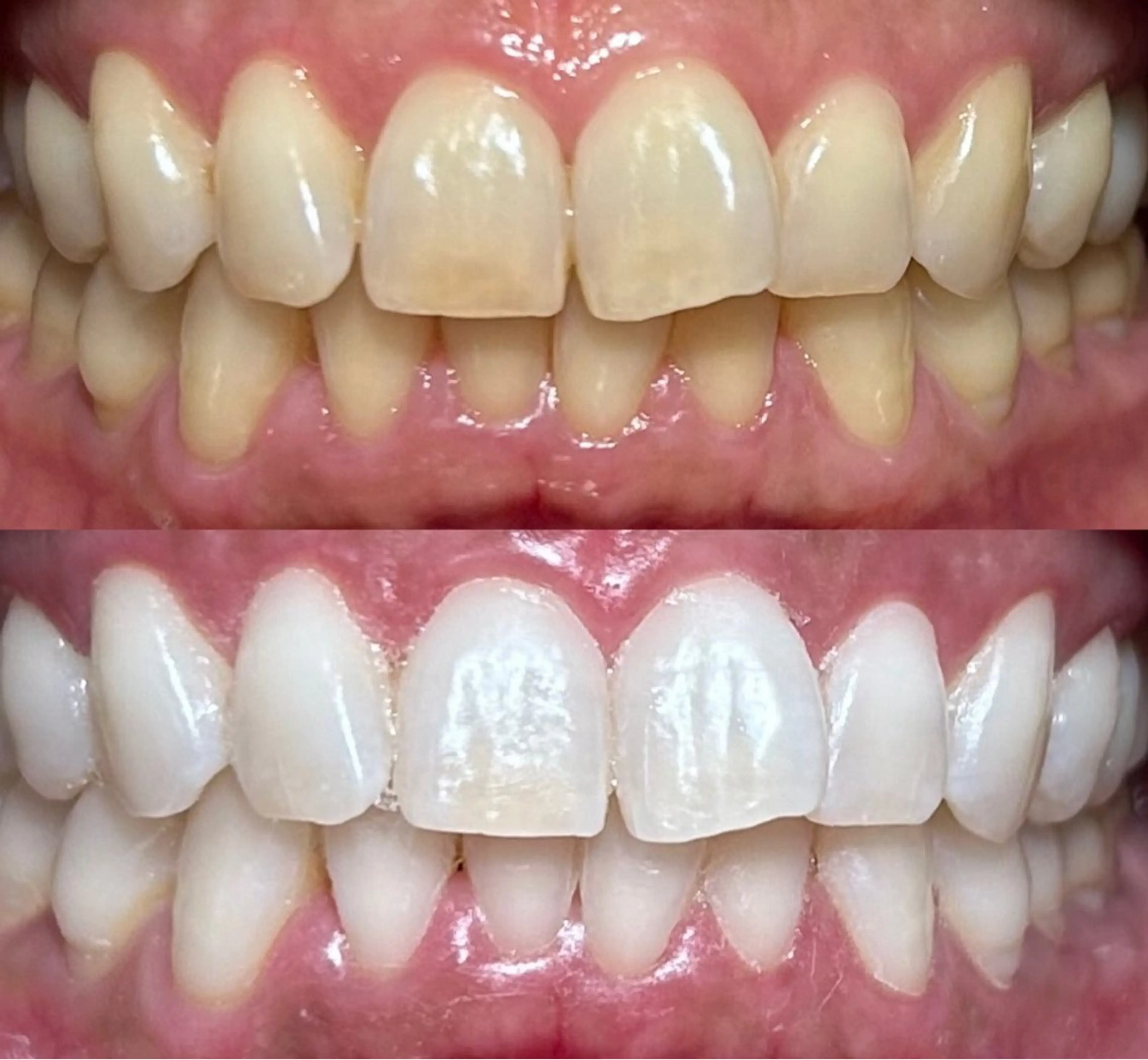 io teeth careのその他イメージ