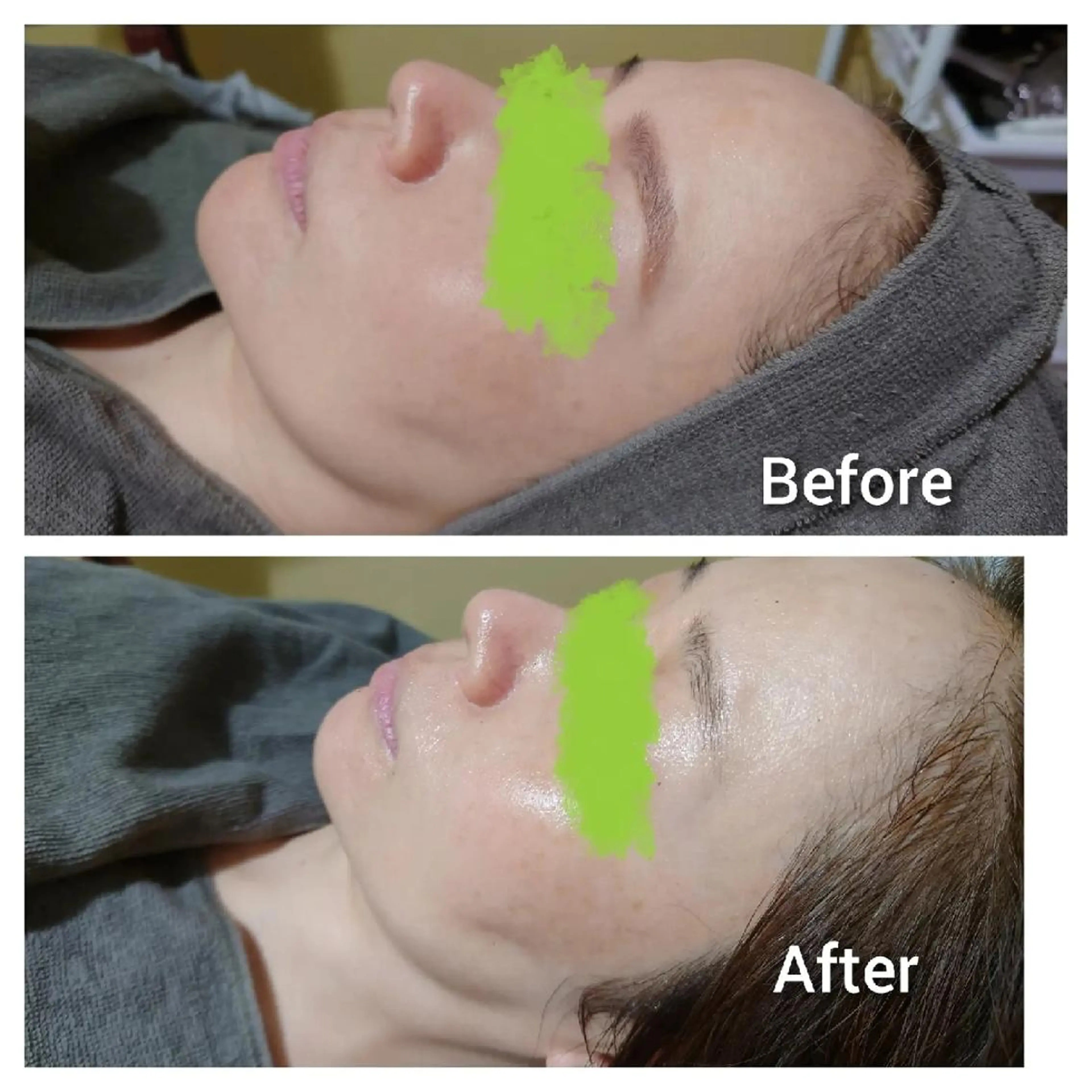 エステ Beauty Salon Luana所属・Luanaまつパ脱毛 ハーブピーリング眉毛のマツエク・マツパデザイン