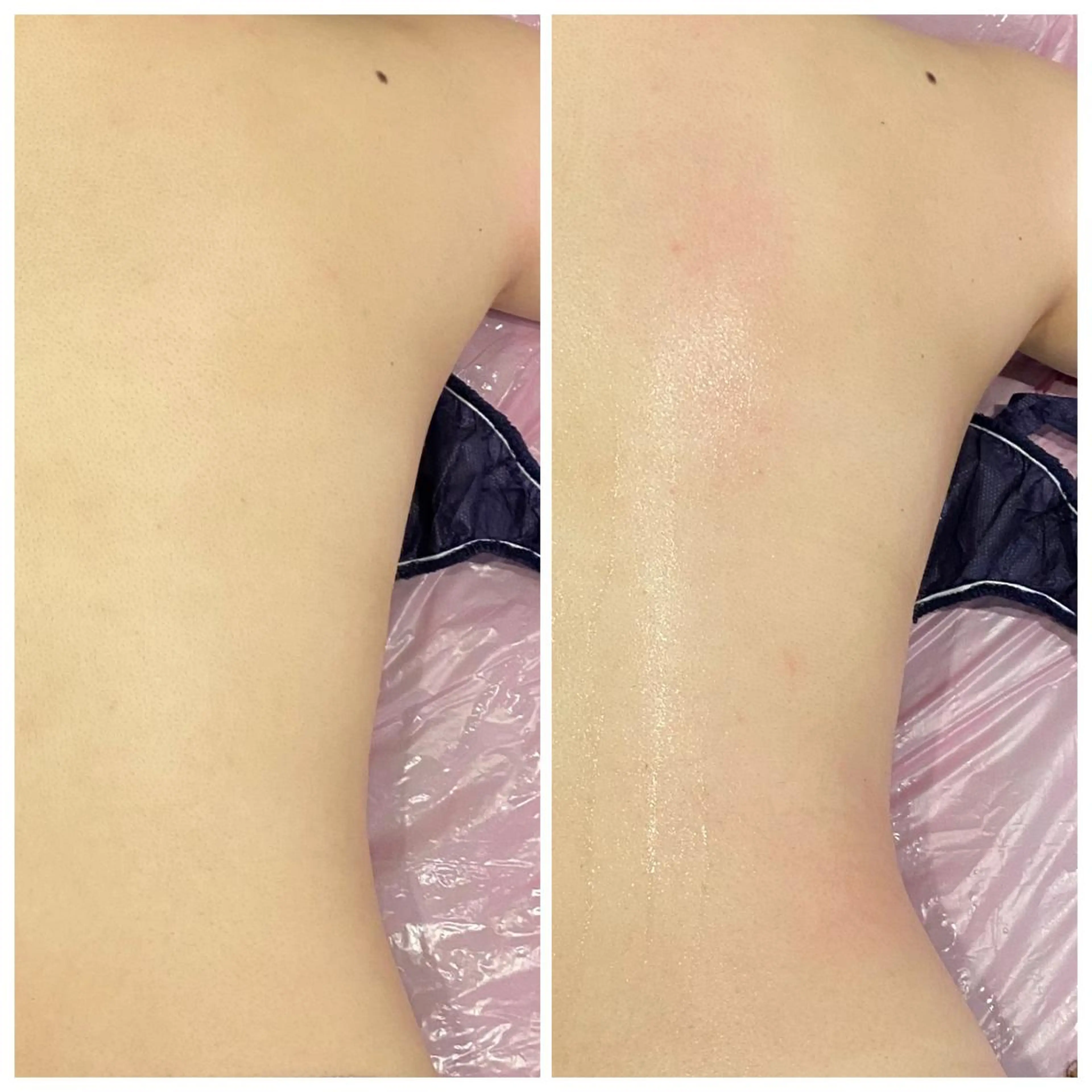 エステ リラク 小顔EX心斎橋 REVIハーブのエステ・リラクイメージ