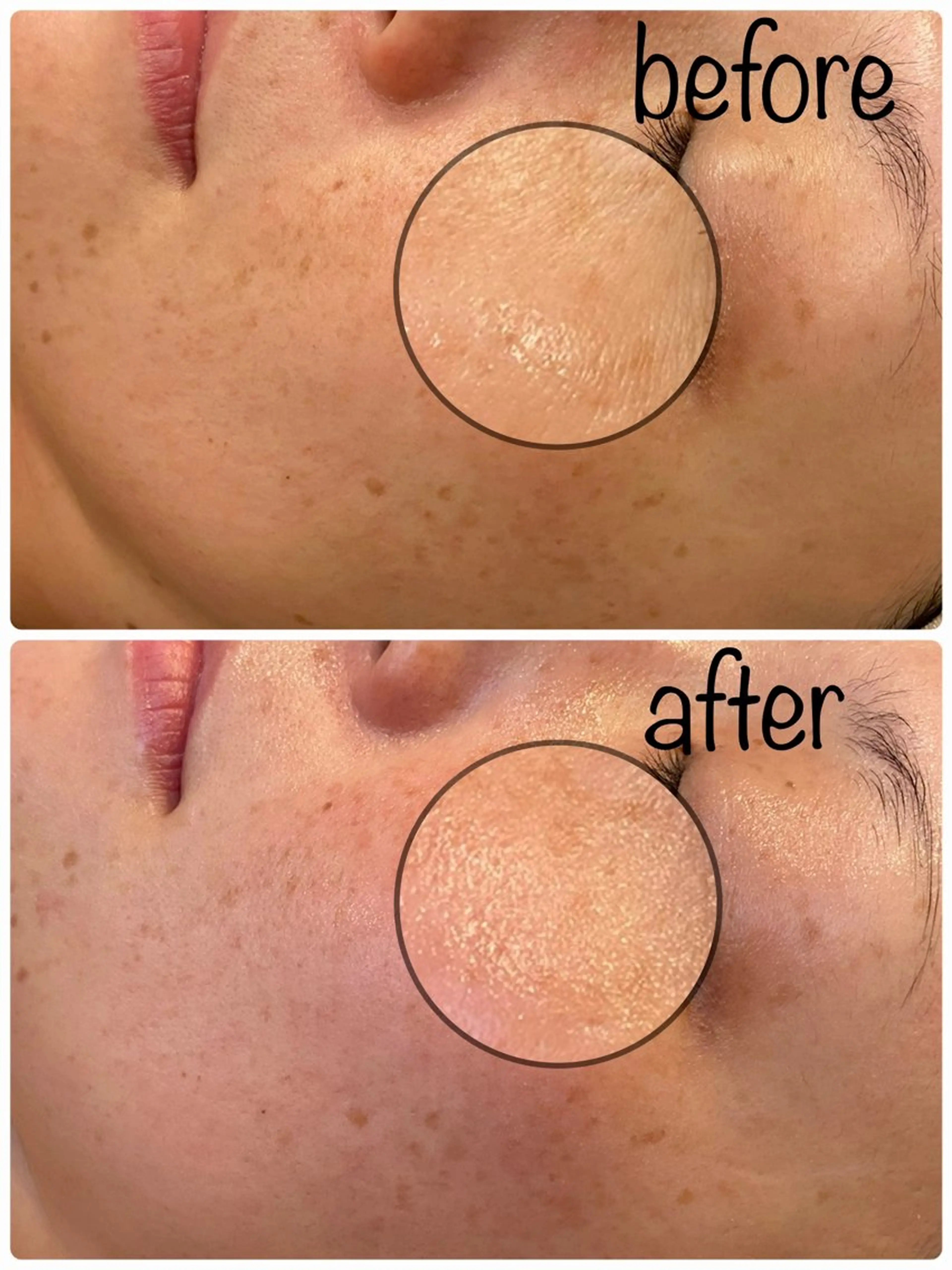 Hisui 小出のエステ・リラクイメージ