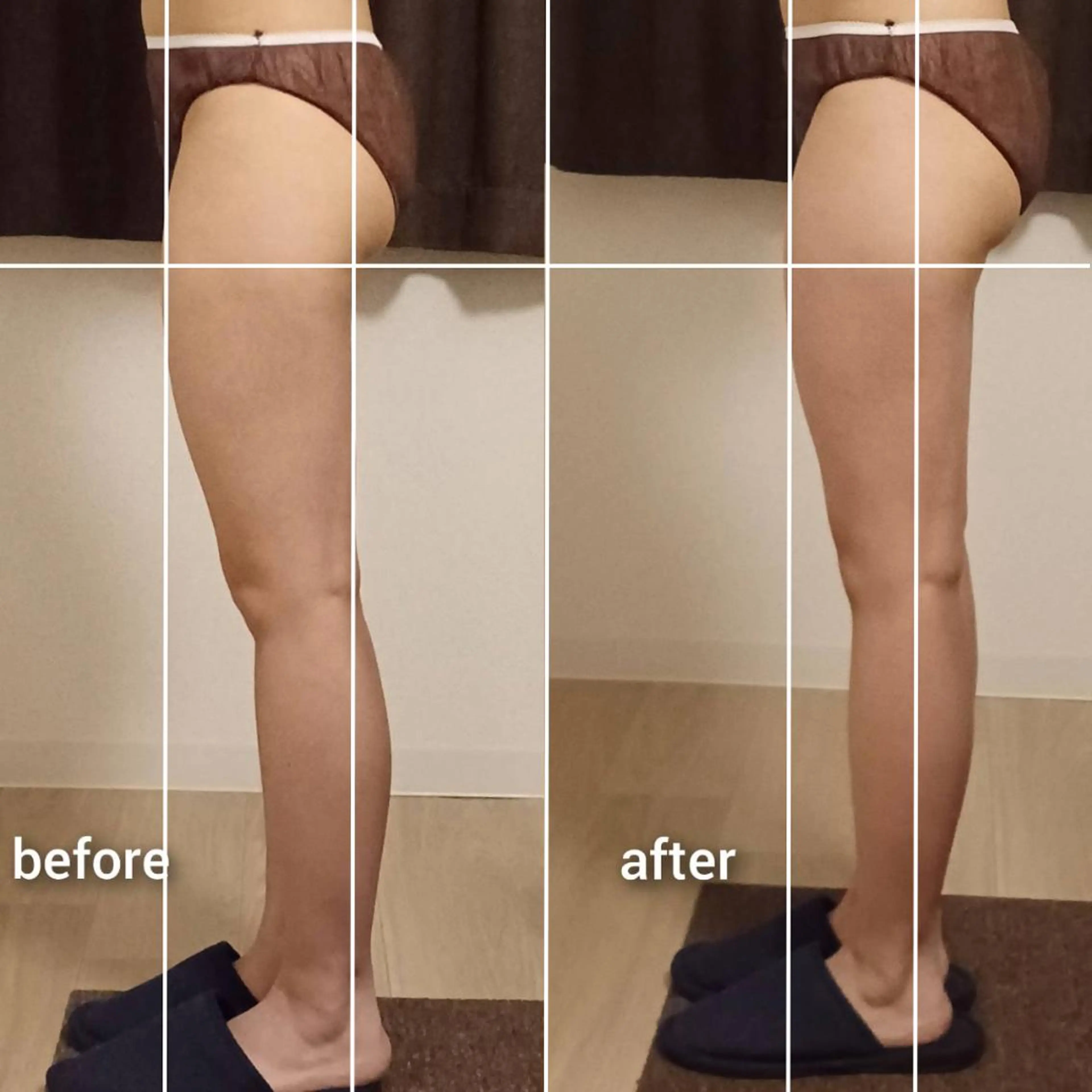 💎学割U24専用💎むくみスッキリ🔥強力デトックスリンパ70分¥5700の写真