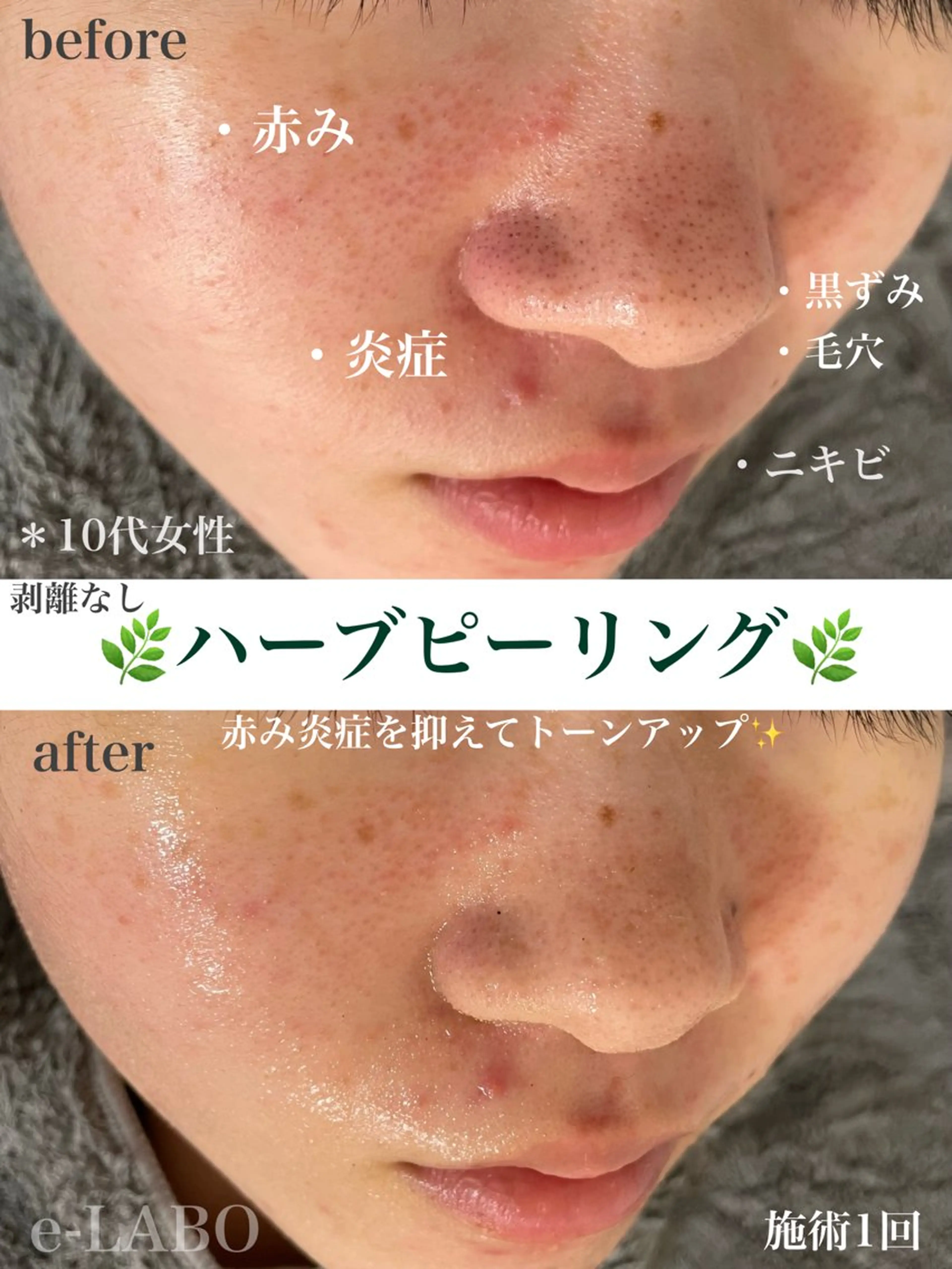 e-LABO こいずみのエステ・リラクイメージ