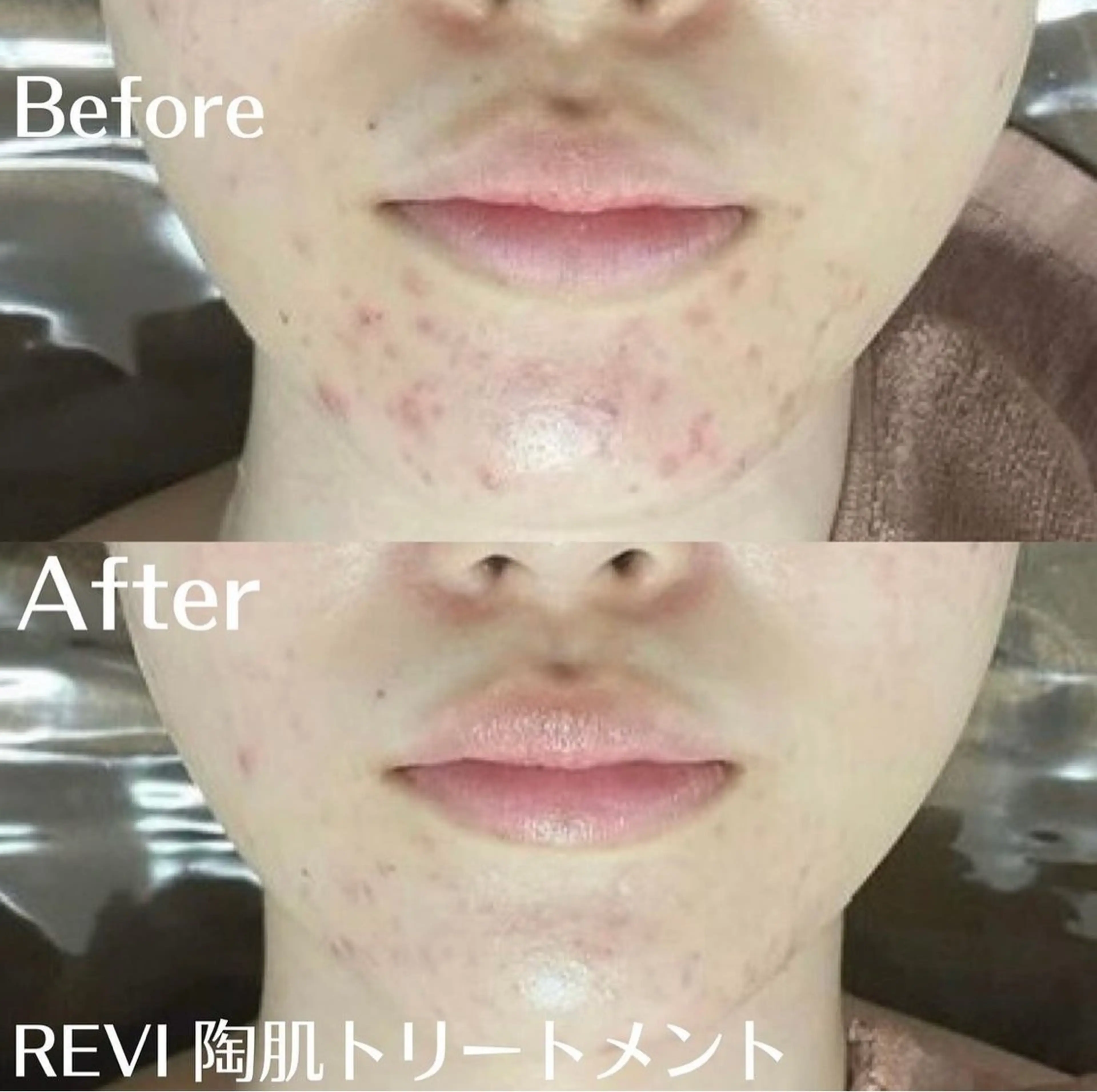 中目黒ハーブピーリン グ🌿ララピールのエステ・リラクイメージ