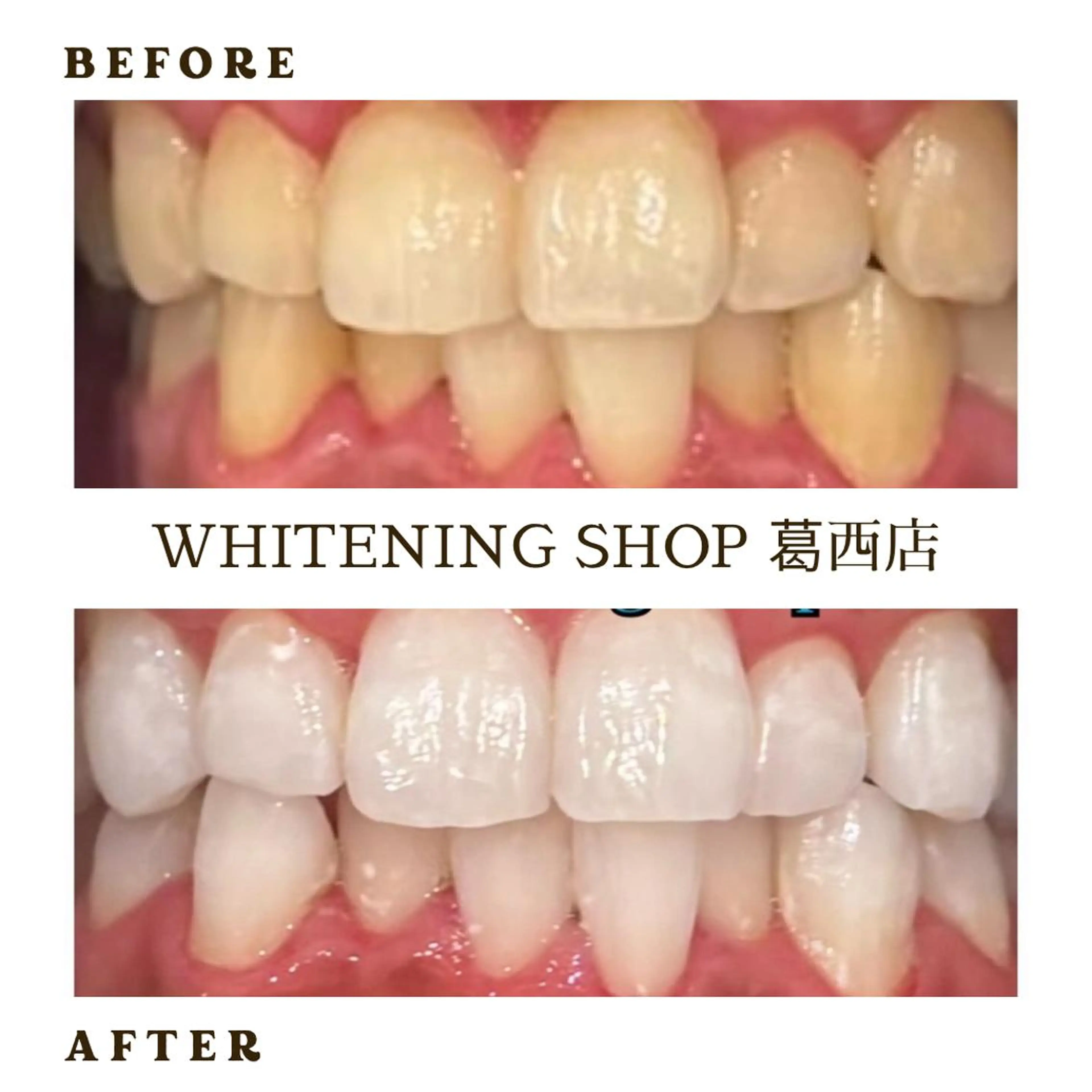 メンズ その他 ホワイトニング ショップ葛西店のその他イメージ