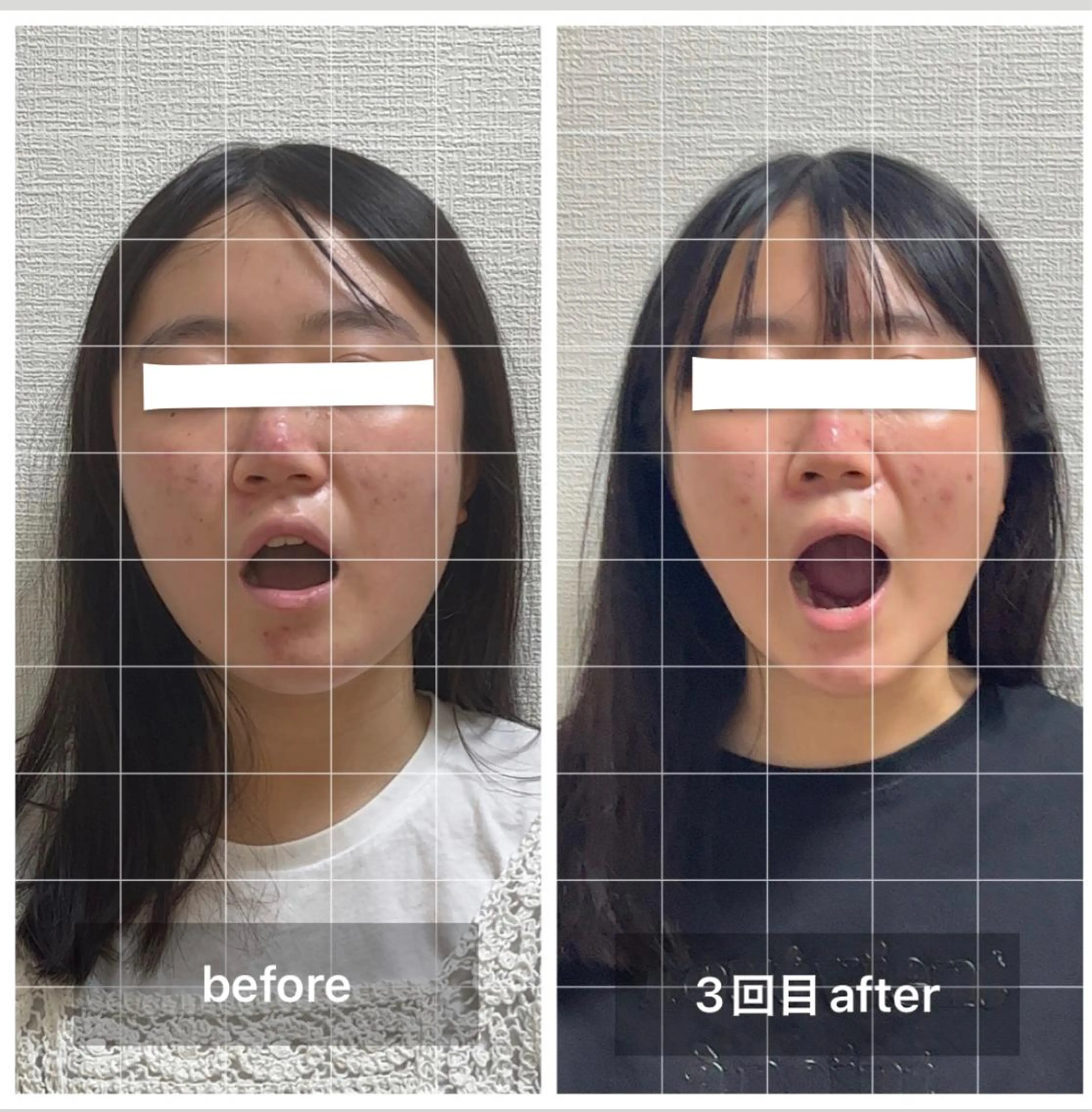 Eclavie所属・エクラヴィ 小顔・エイジングケアのエステ・リラクイメージ