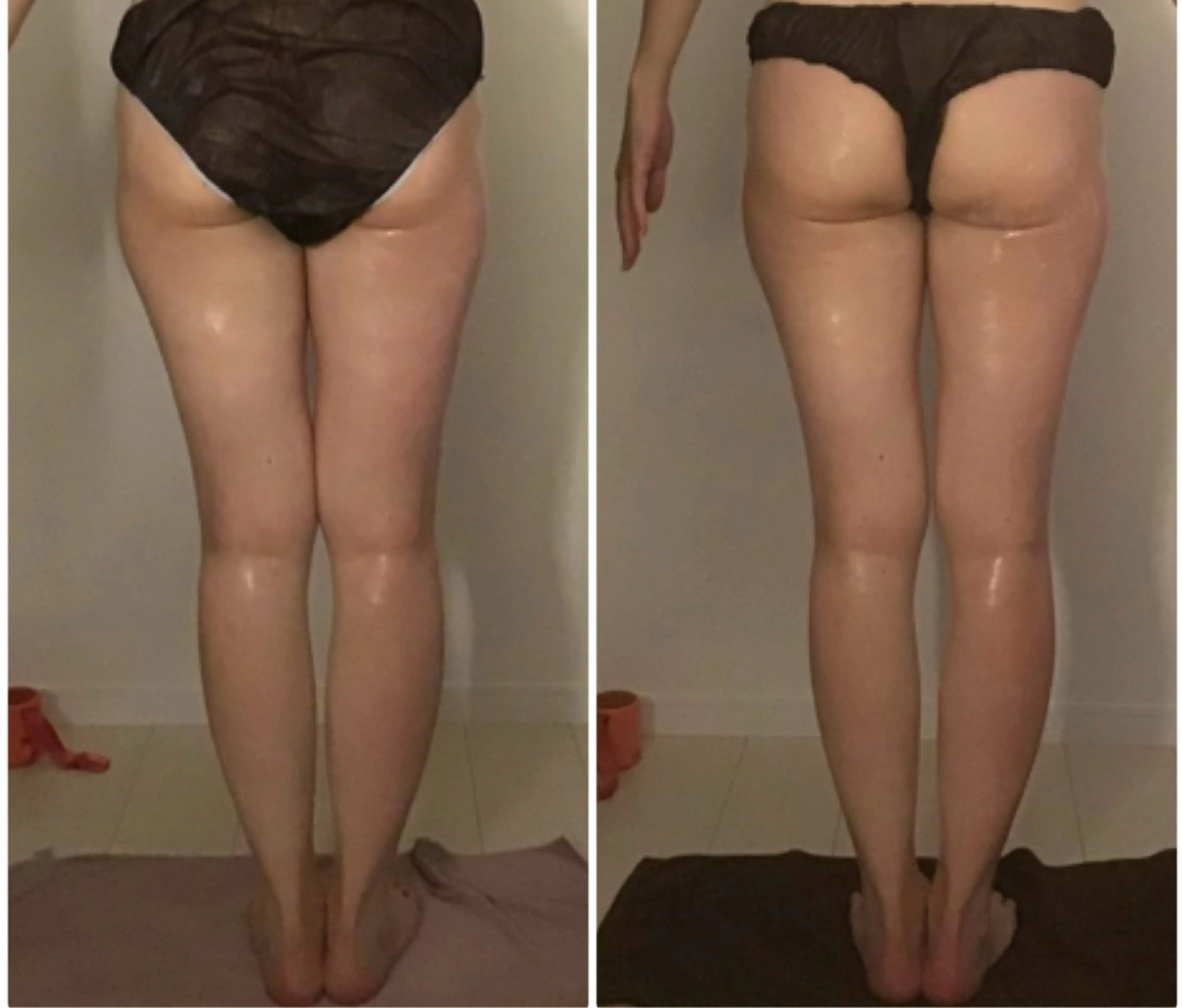 エステ リラク BELLEFINE 💕痩身・小顔・脱毛のエステ・リラクイメージ