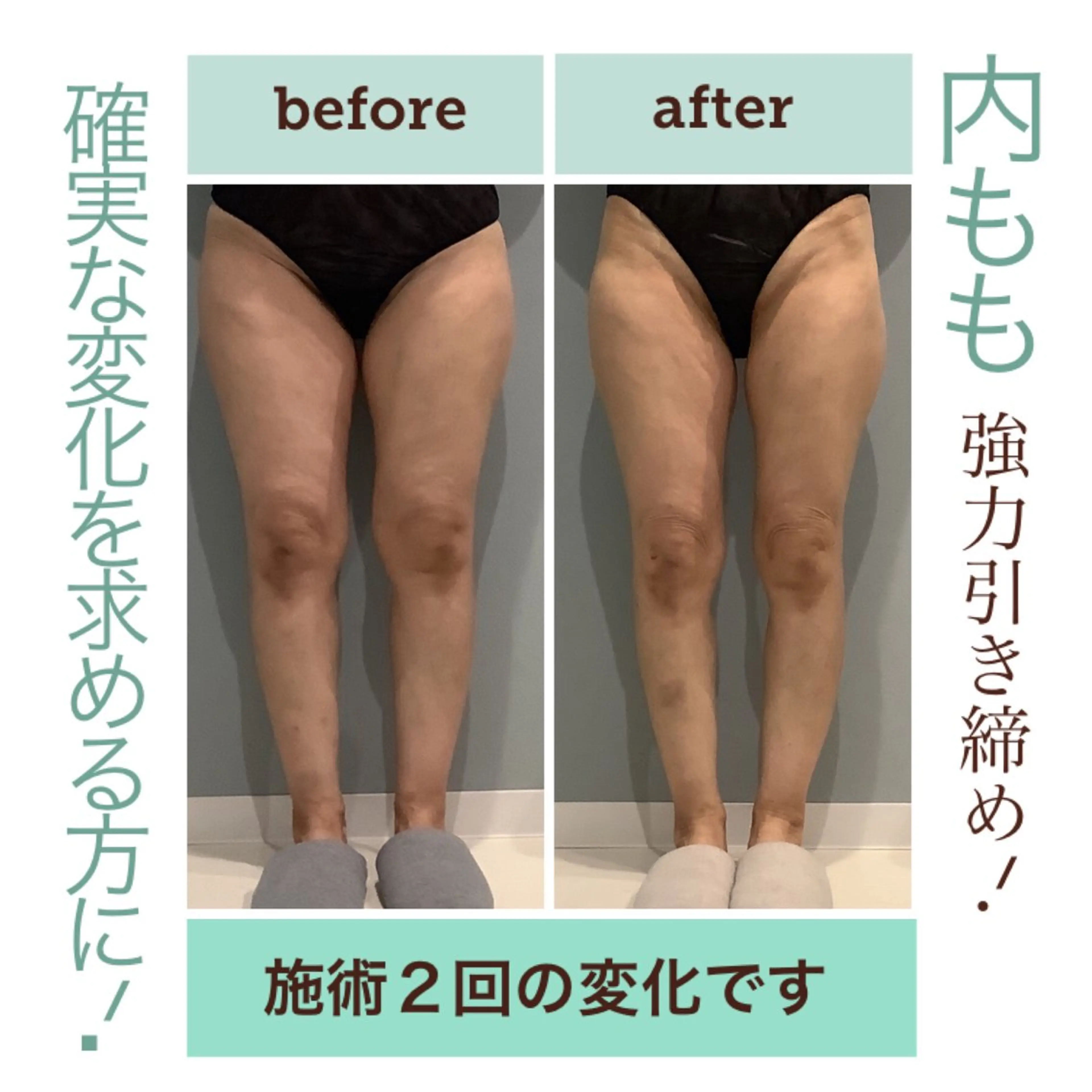 エステ エステサロン JURISのエステ・リラクイメージ