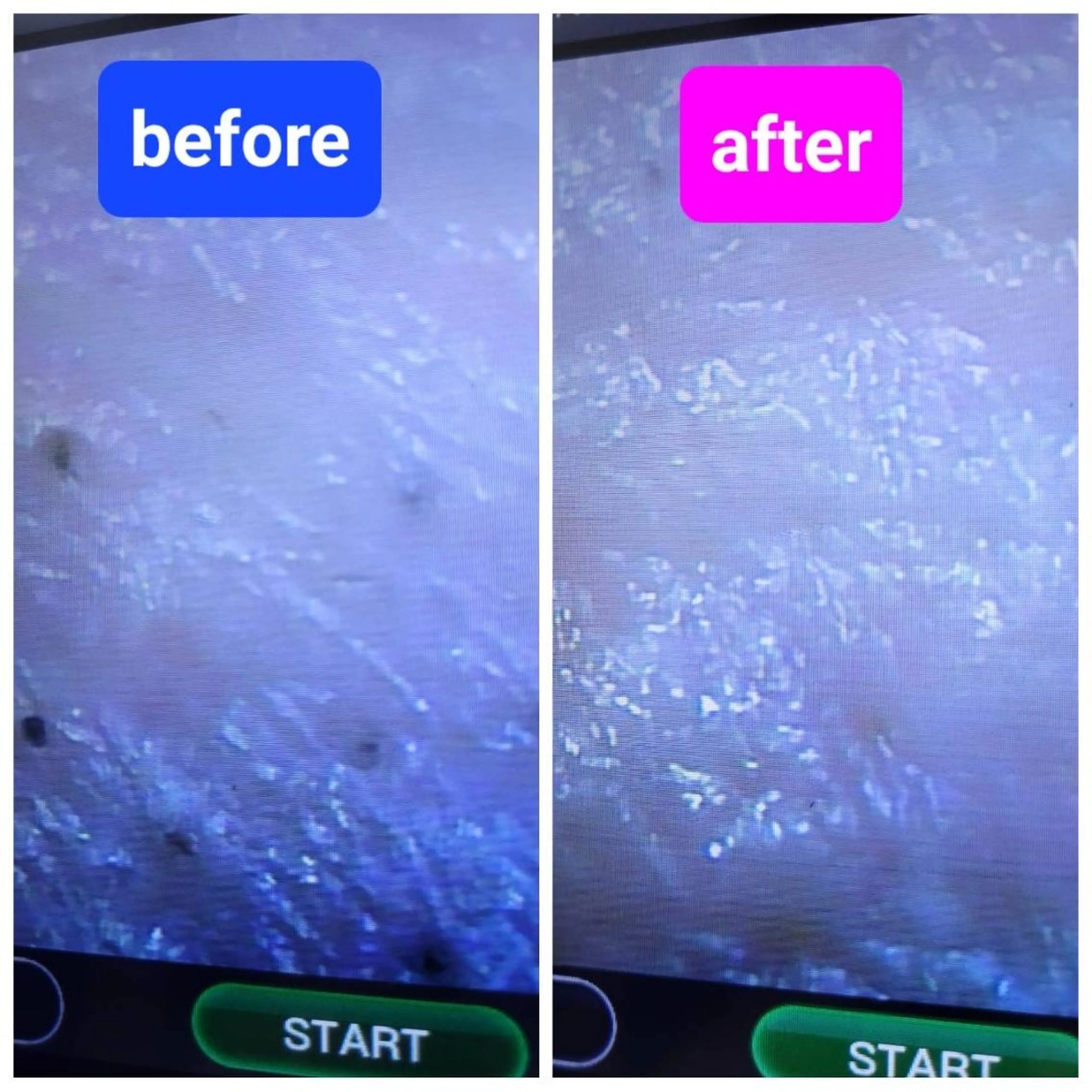 エステ 小顔/毛穴/肌質改善 💆セラピエージのエステ・リラクイメージ