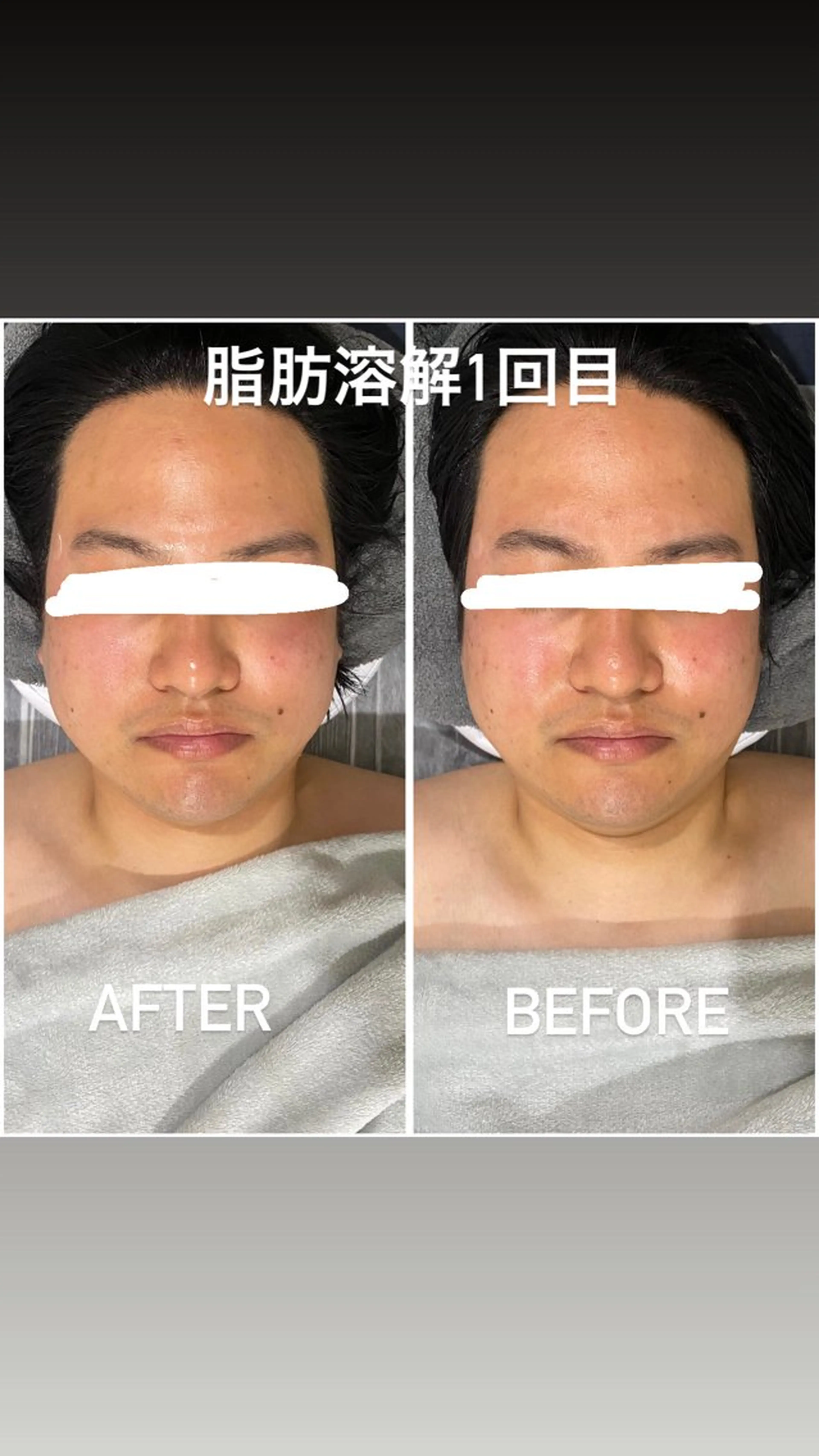 エステ 毛穴洗浄・痩身・脱毛 /アルカンジュのエステ・リラクイメージ